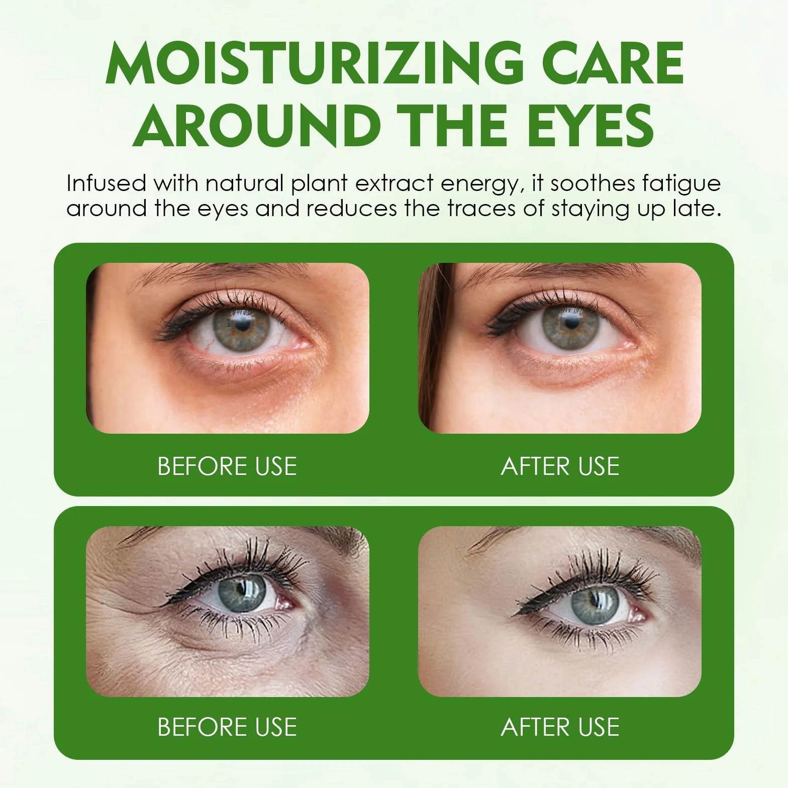 Patchs Yeux Anti Cernes à L’Aloe Vera Et Collagène, Soin Hydratant Réduire Rides Poches Fatigue