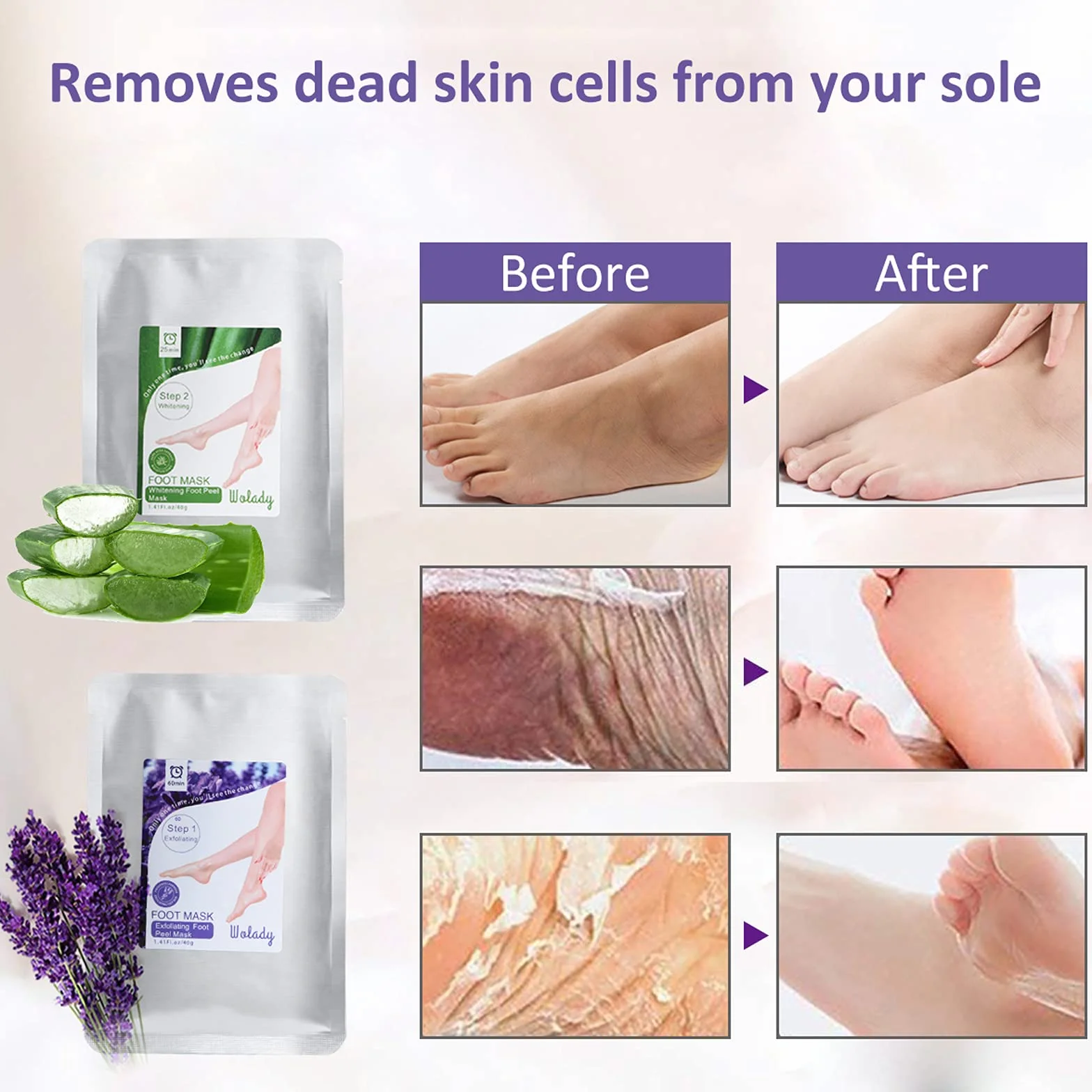 Wolady Masque Peeling Exfoliant Pieds Anti-Callosités Chaussette Hydratante 2 Paires Lavande Aloe Vera
