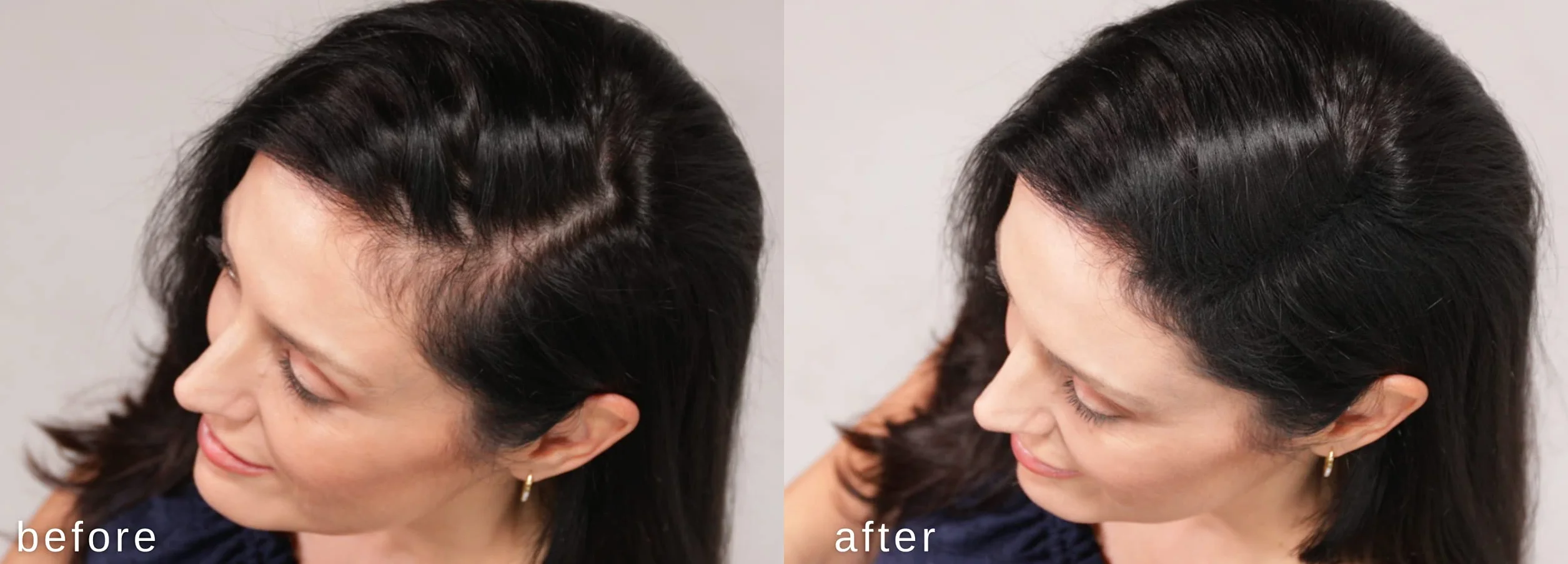 Hypoallergénique fibres épaississantes cheveux Marron foncé testé dermatologues