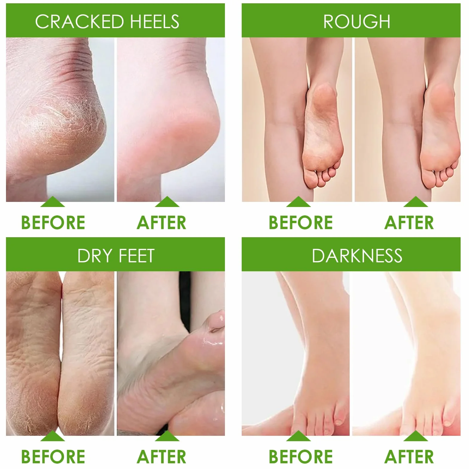 Masque Pied Peeling Nourrissant Aloe Vera pour Pieds Secs et Fendillés