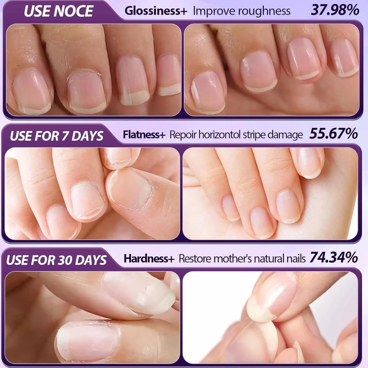 Sassytip Stylo Repousse-Cuticules à L'huile 2 ml Dissolvant Cuticules Huile Ongles Rose Lavande Soin Manucure