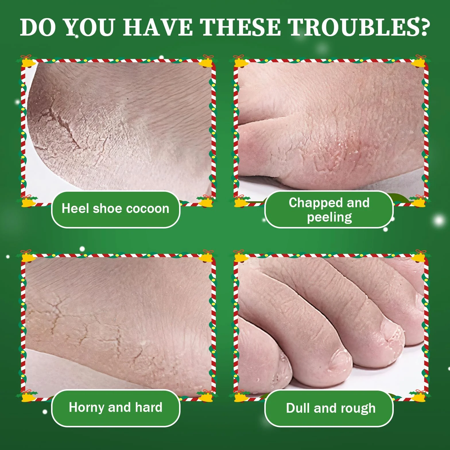 Masque Pieds Peeling Exfoliant Aloe Vera, Soin Pieds pour Enlever Callosités et Peau Morte