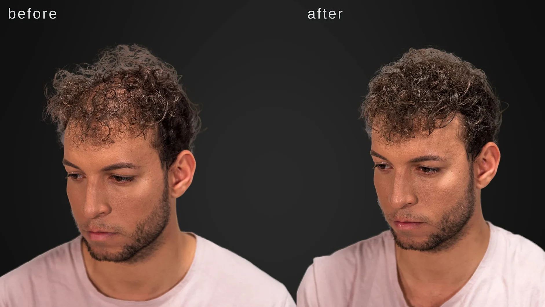 Hypoallergénique fibres épaississantes cheveux Marron foncé testé dermatologues