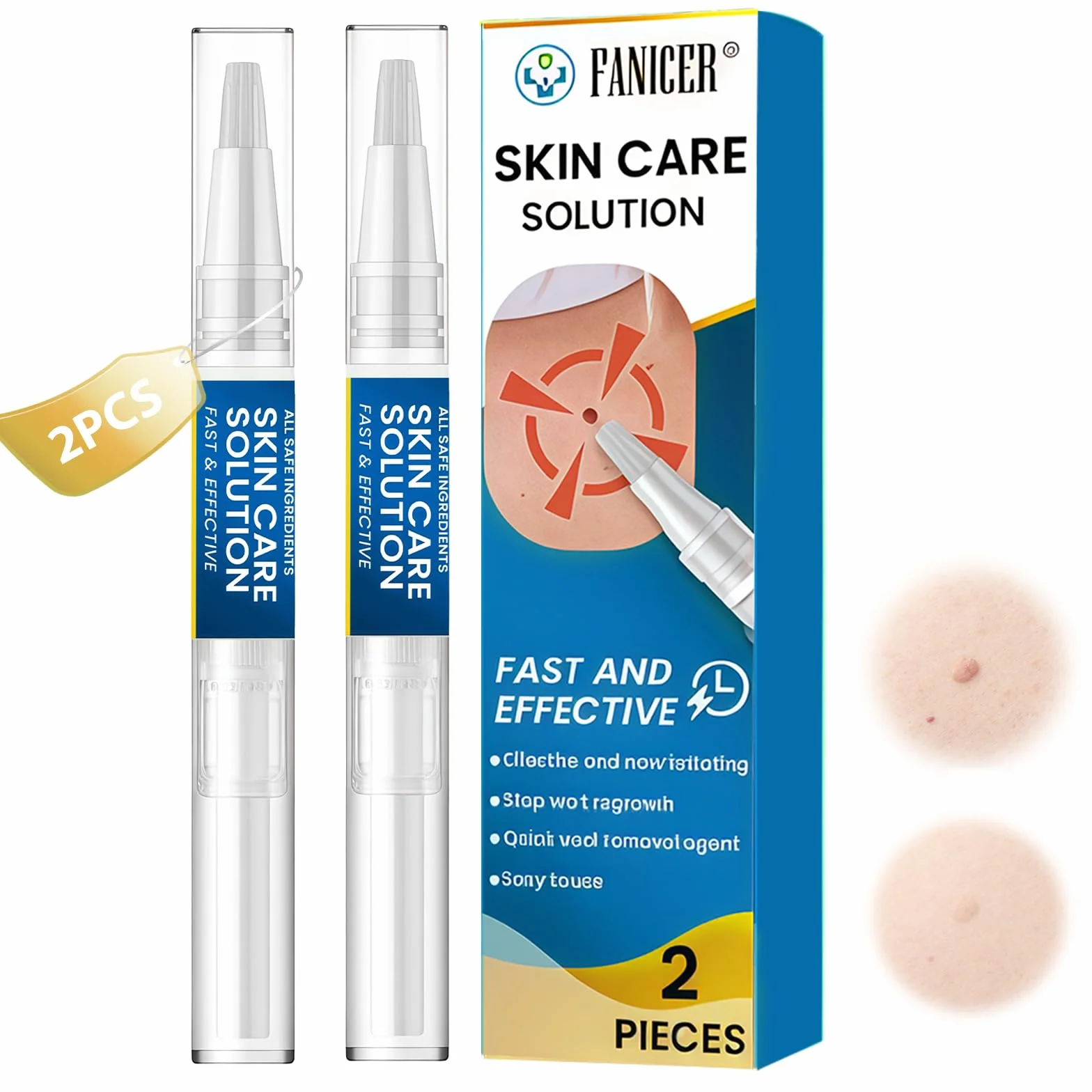 Stylo Anti Verrue 5ml 2 Pièces, Liquide de Soin Verrues, Éliminateur de Cuticules