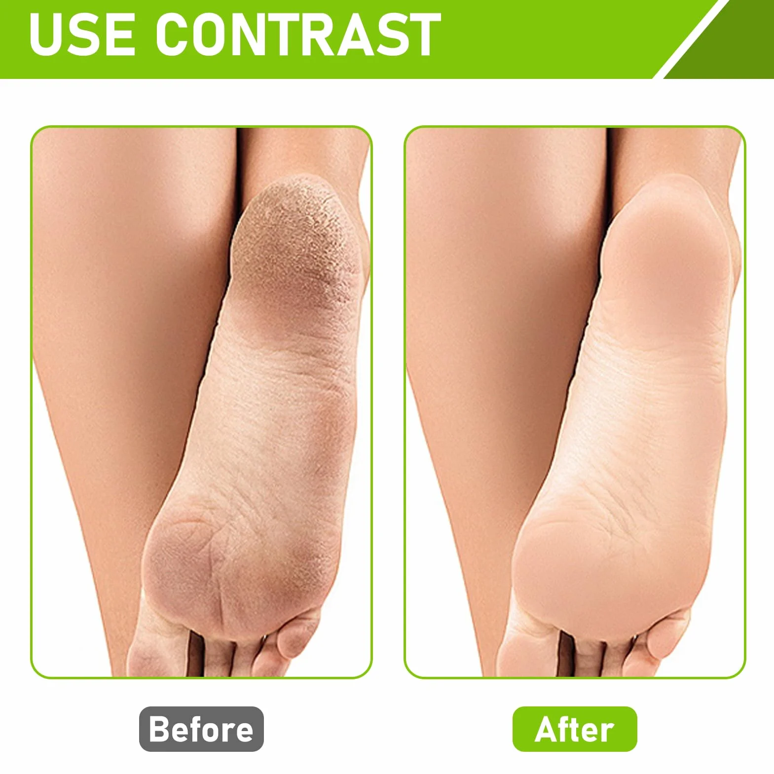 Masque Pied Exfoliant Peeling avec Acide Lactique, Olive et Glycérine pour Pieds Très Secs et Abîmés