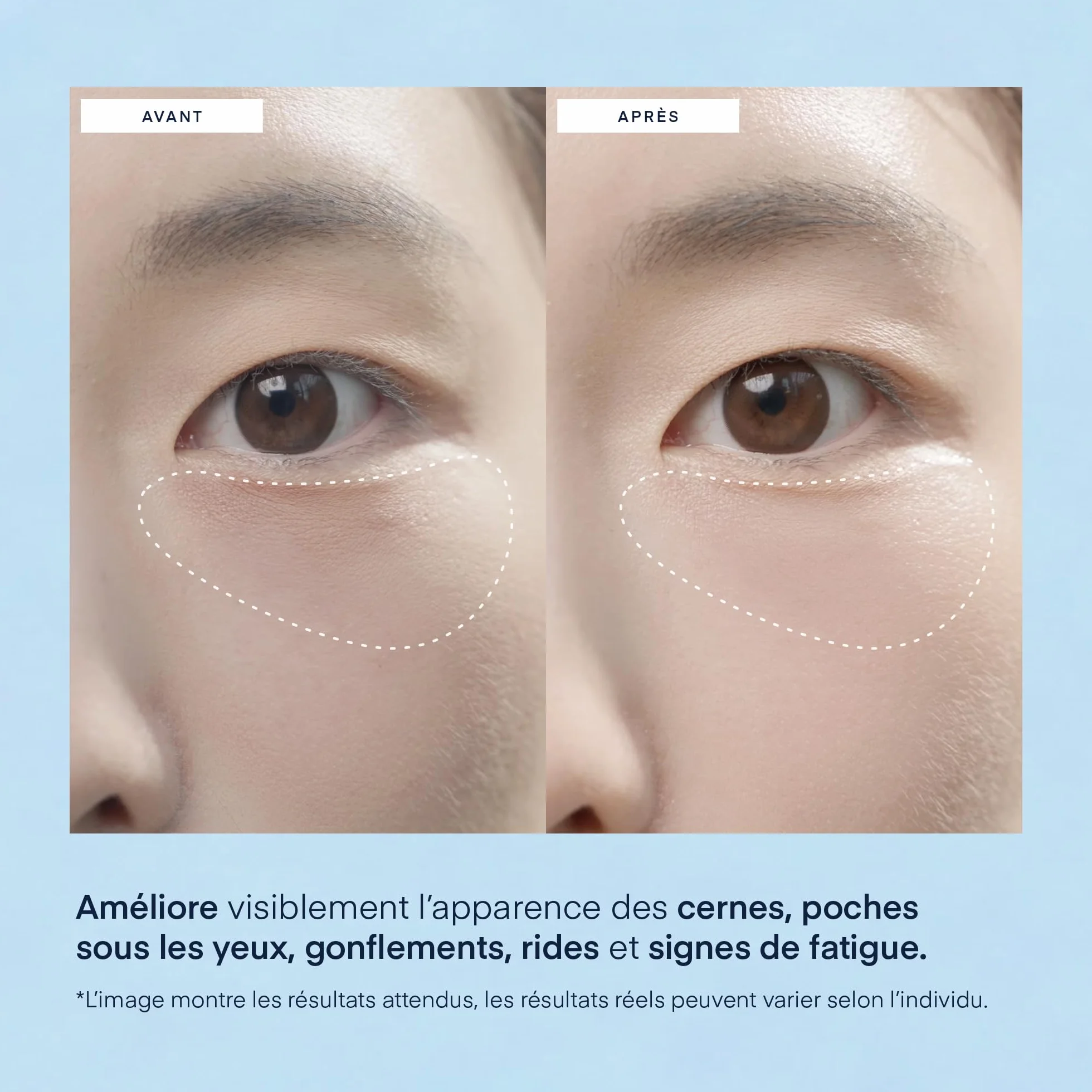 Skincare Coréen Patchs Yeux Anti-Poches Rides Acide Hyaluronique Niacinamide Caféine 30 Paires