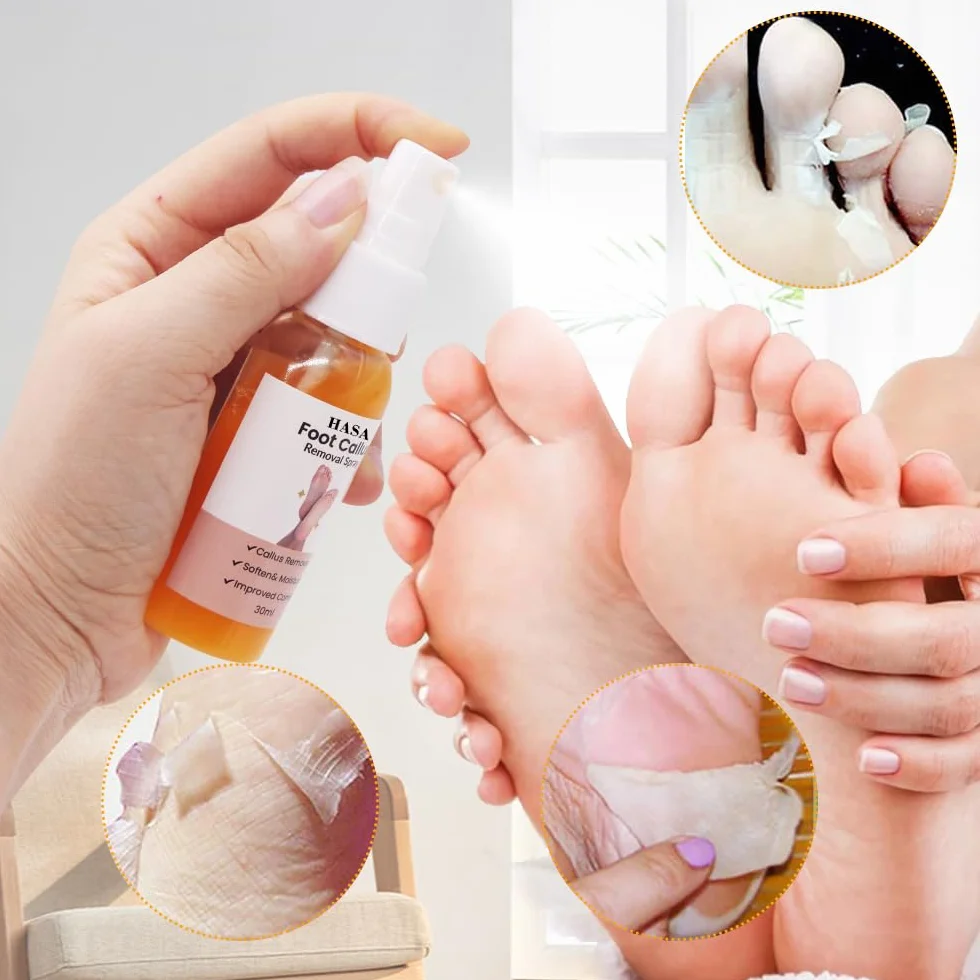 Spray anti callosités des pieds, exfoliant hydratant nourrissant pour pieds secs