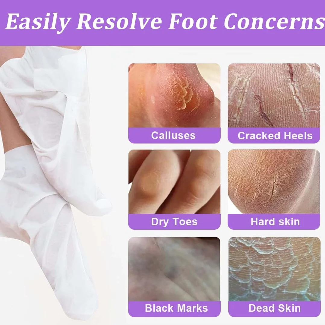 Masque peeling pieds exfoliant, 2 paires, Callus peeling