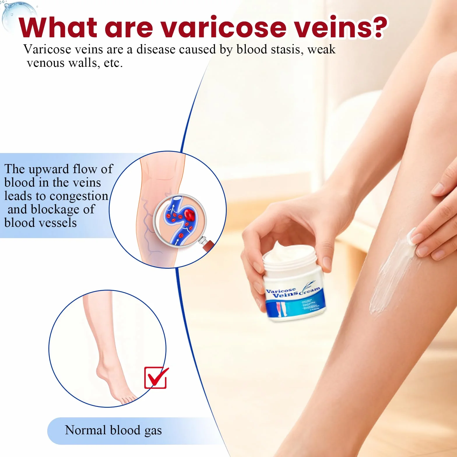 Crème pour Varices 20g Soulage Jambes Fatiguées Lourdes