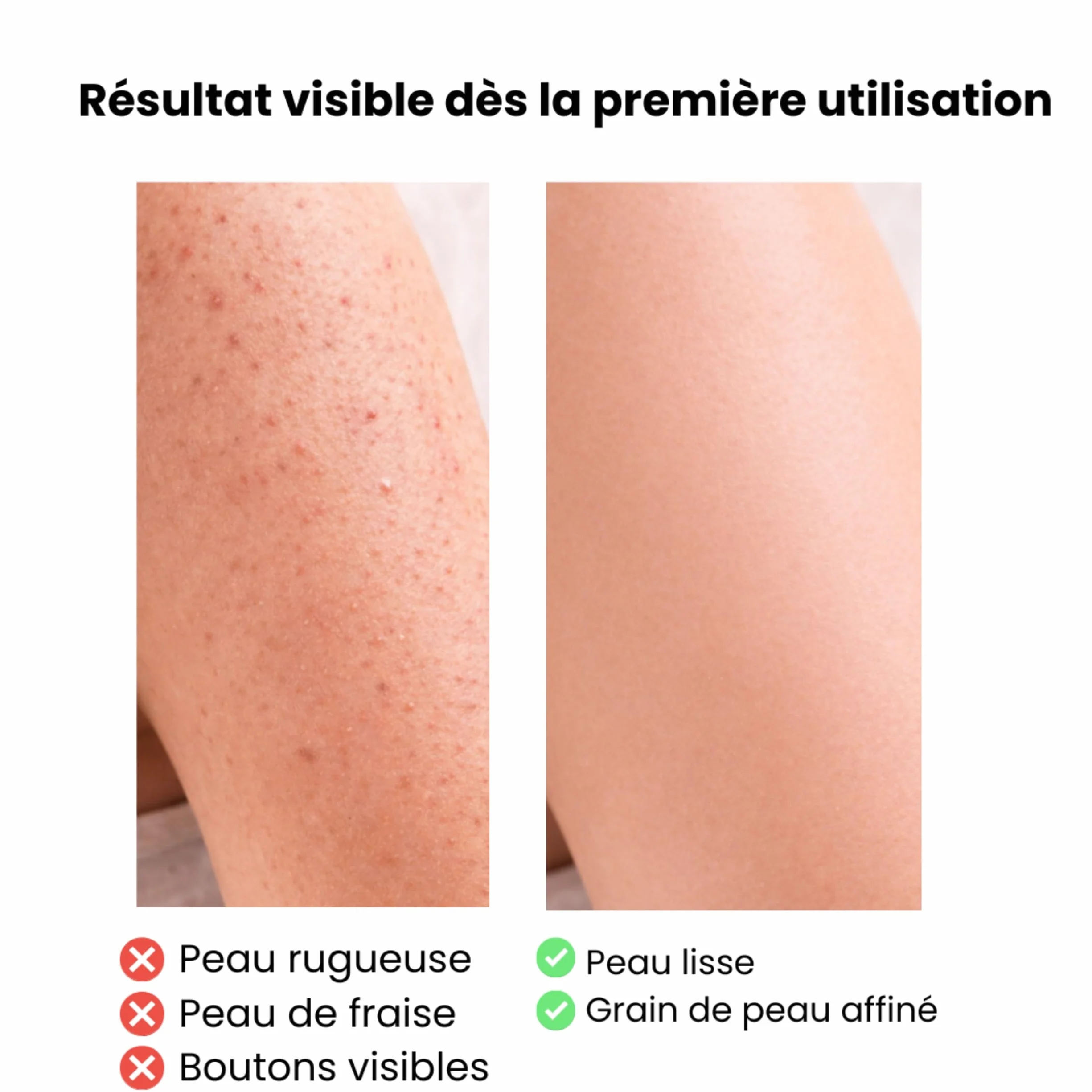 Gants Exfoliants Visage et Corps, Gant de Kessa Crin Viscose Gommage Élimine Cellules Mortes Peau d'Orange