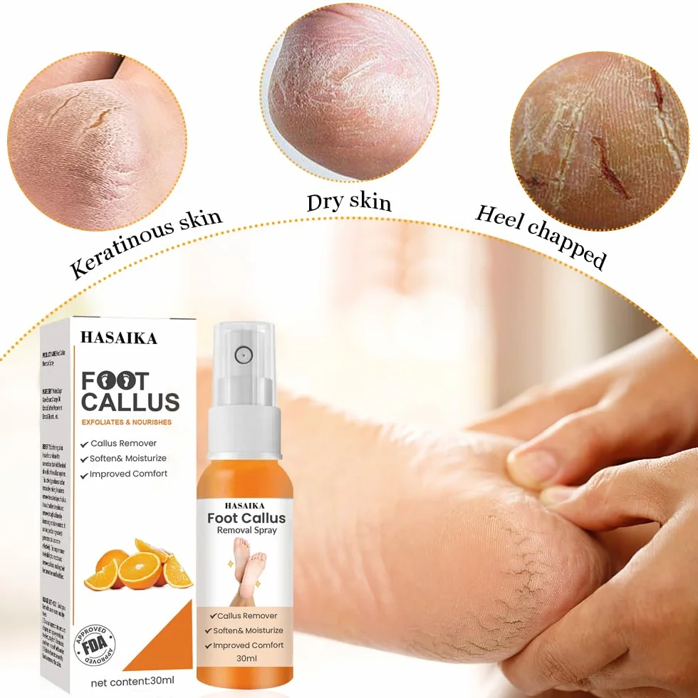 Spray anti callosités des pieds, exfoliant hydratant nourrissant pour pieds secs
