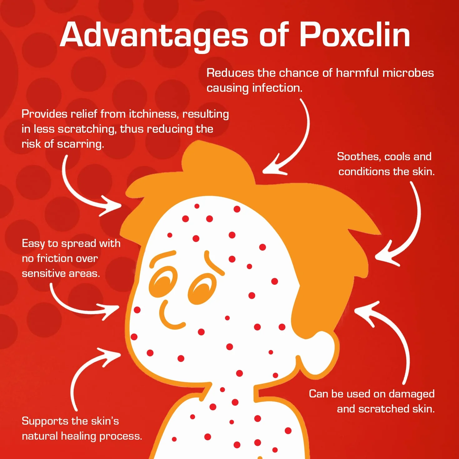 Poxclin Cool Mousse for Children with Chickenpox 100ml