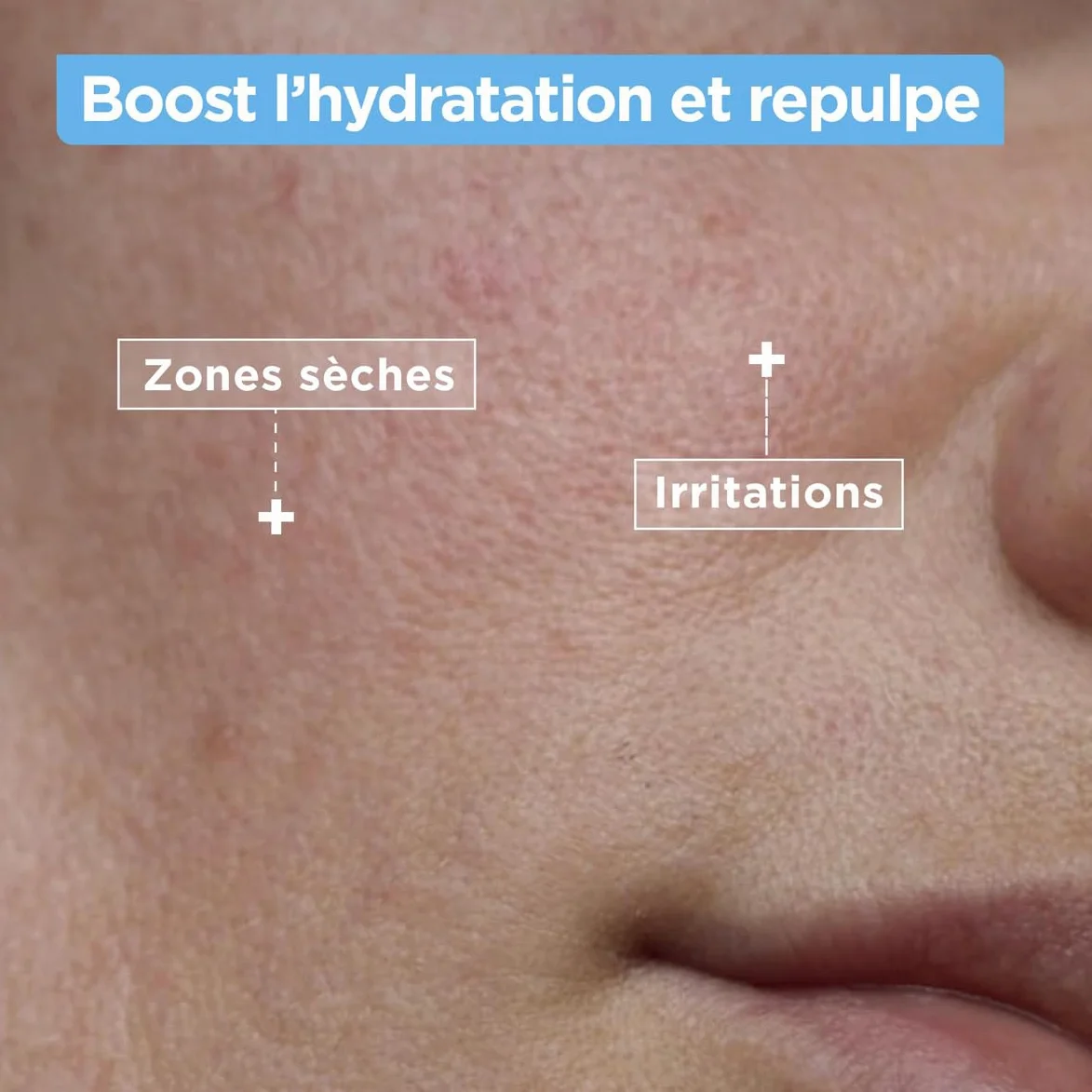 Mixa Nettoyant Confort Anti-Sécheresse Squalane Acide Hyaluronique Peaux Déshydratées Sensibles 150 ml