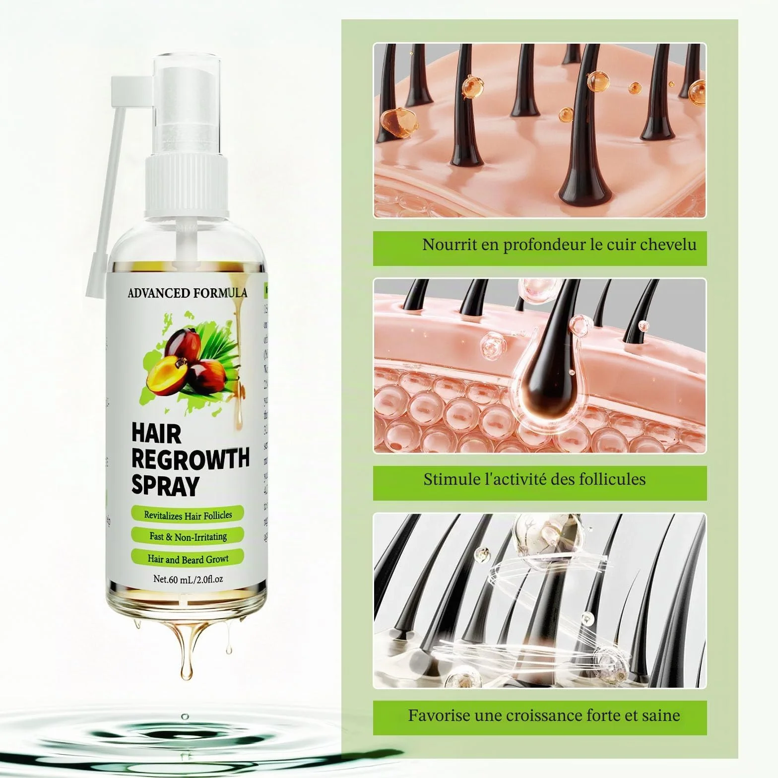 Huile De Ricin/Romarin/Batana 3 En 1 Pousse Cheveux Rapide, Booster Croissance Cheveux, Renforce Racines, 60 ml