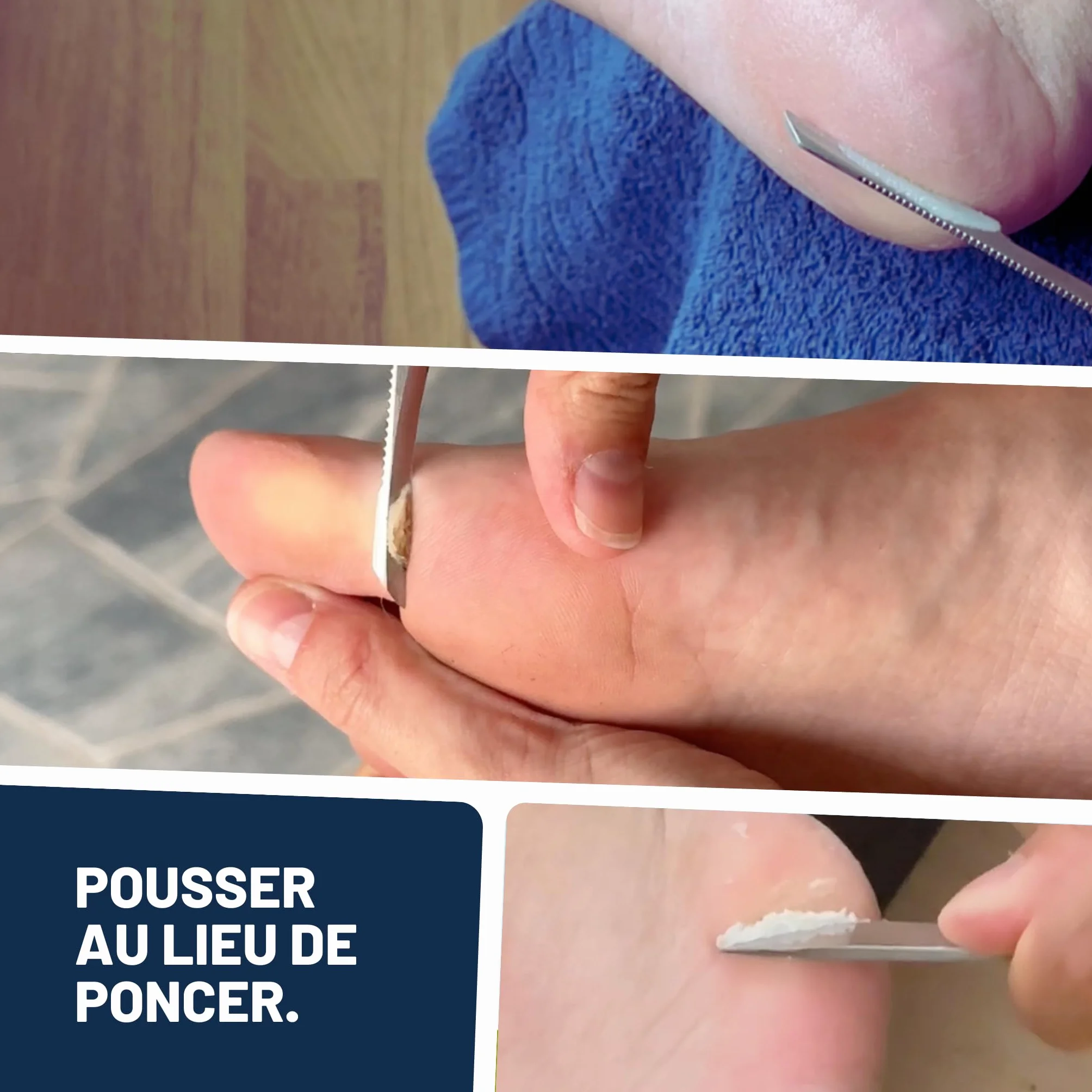 Mr. Fuss Solution No. 4 pour enlever la callosité - 250ml Advanced Pack Basic