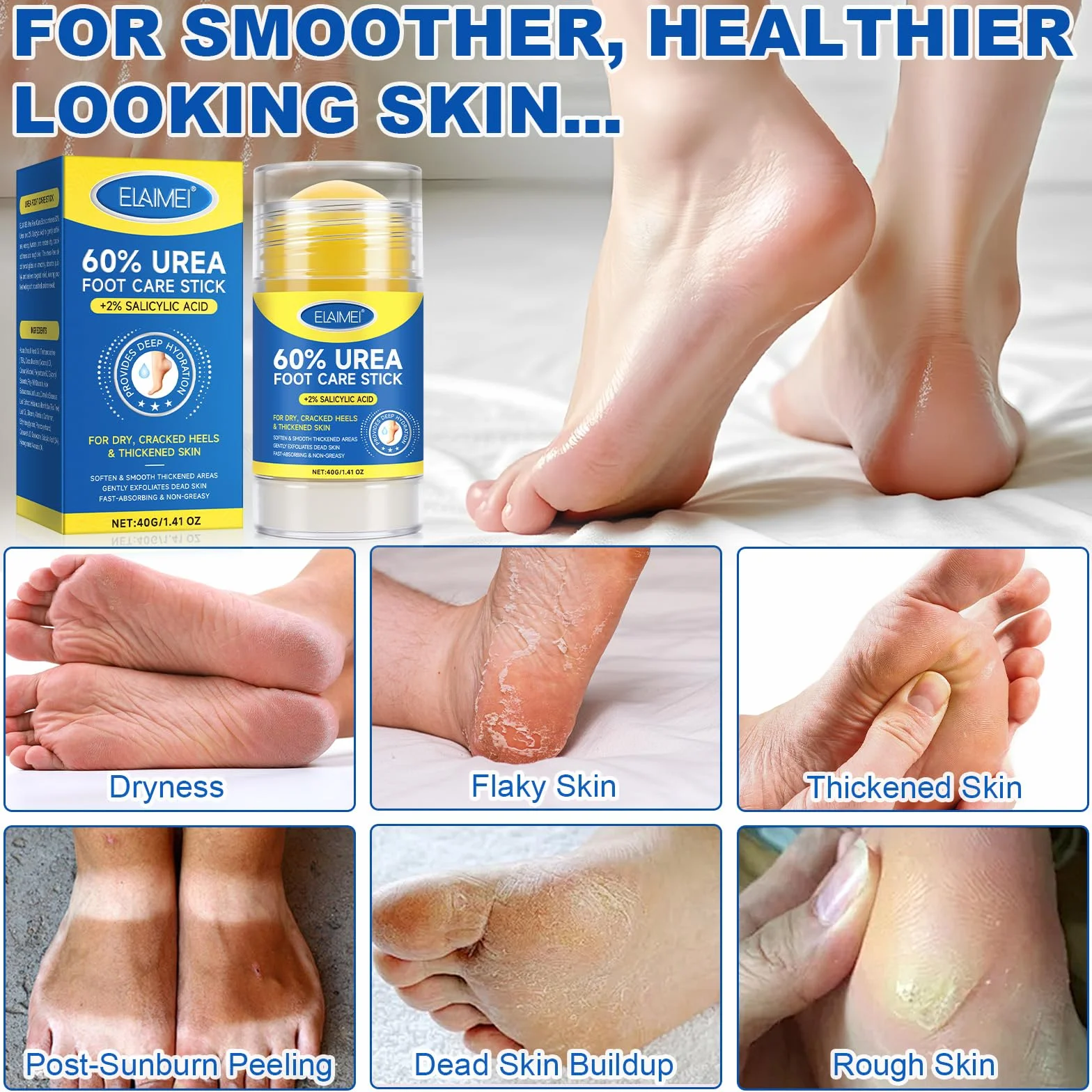 Bâton Réparateur Pieds Urée 60% Acide Salicylique 2% Soin Intensif Talons Fendillés Peau Très Sèche Stick Hydratant Absorption Rapide
