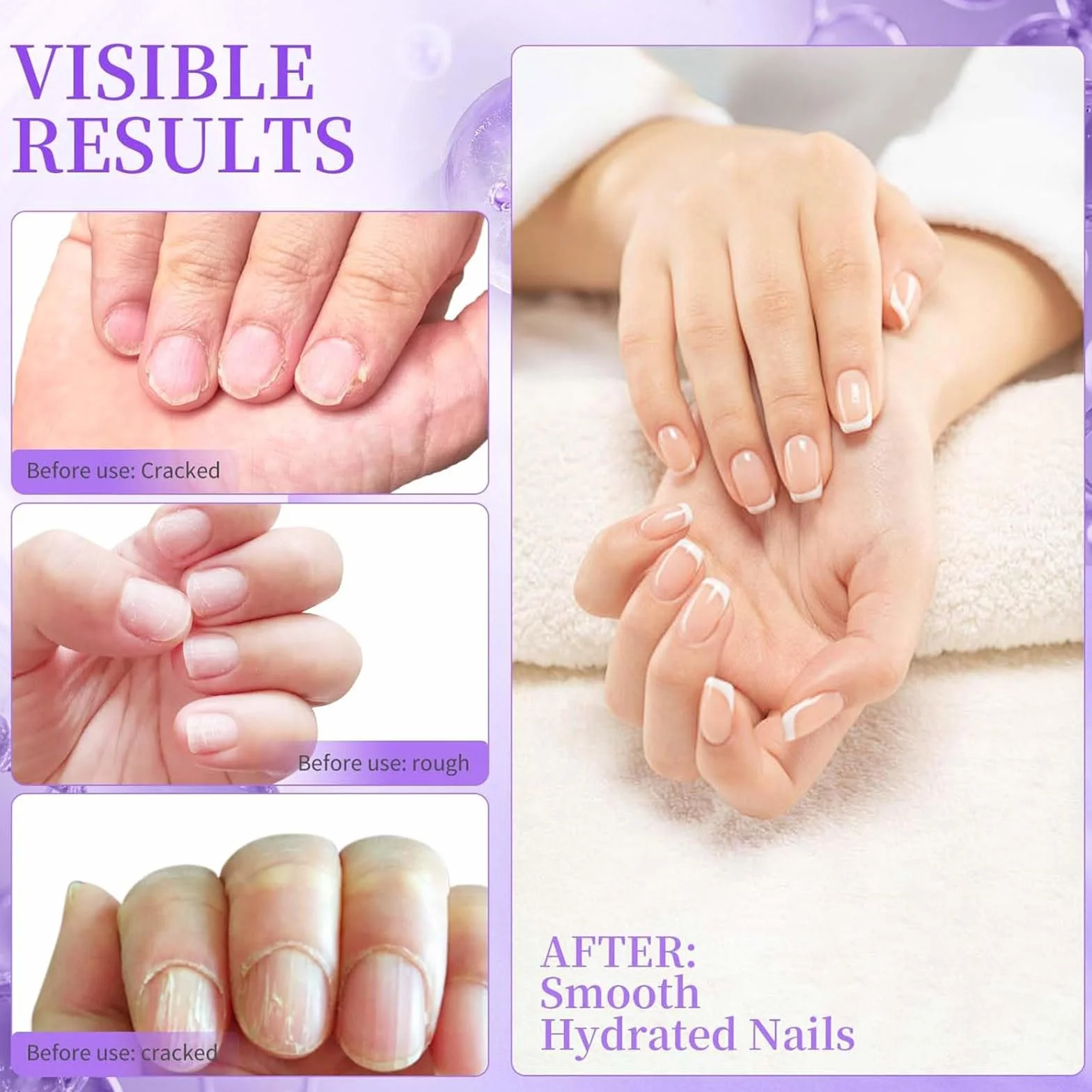 Sassytip Stylo Repousse-Cuticules à L'huile 2 ml Dissolvant Cuticules Huile Ongles Rose Lavande Soin Manucure