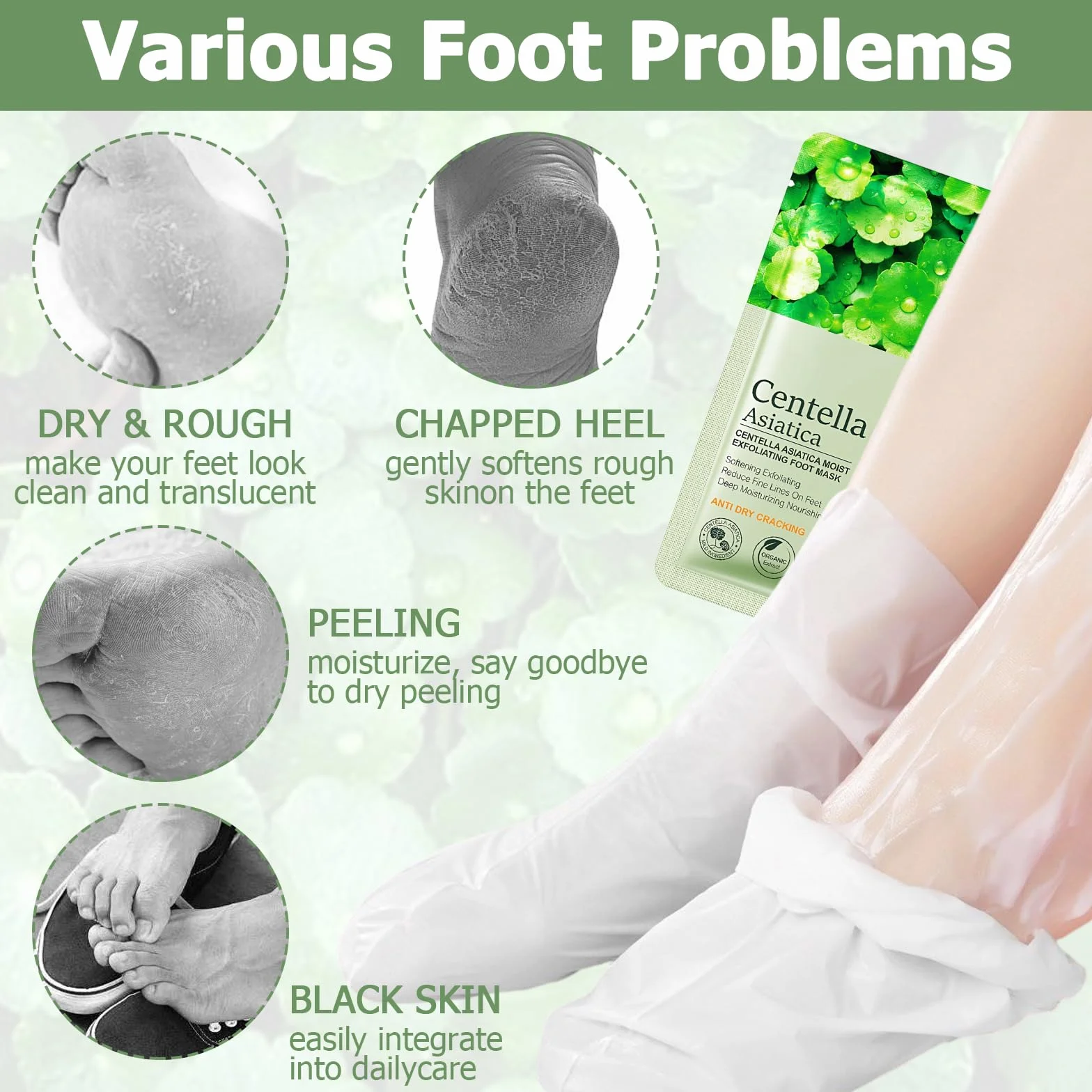 Masque Pieds Peeling Exfoliant 4 Paires, Centella Asiatica, Pieds Très Secs, Soin Nourrissant
