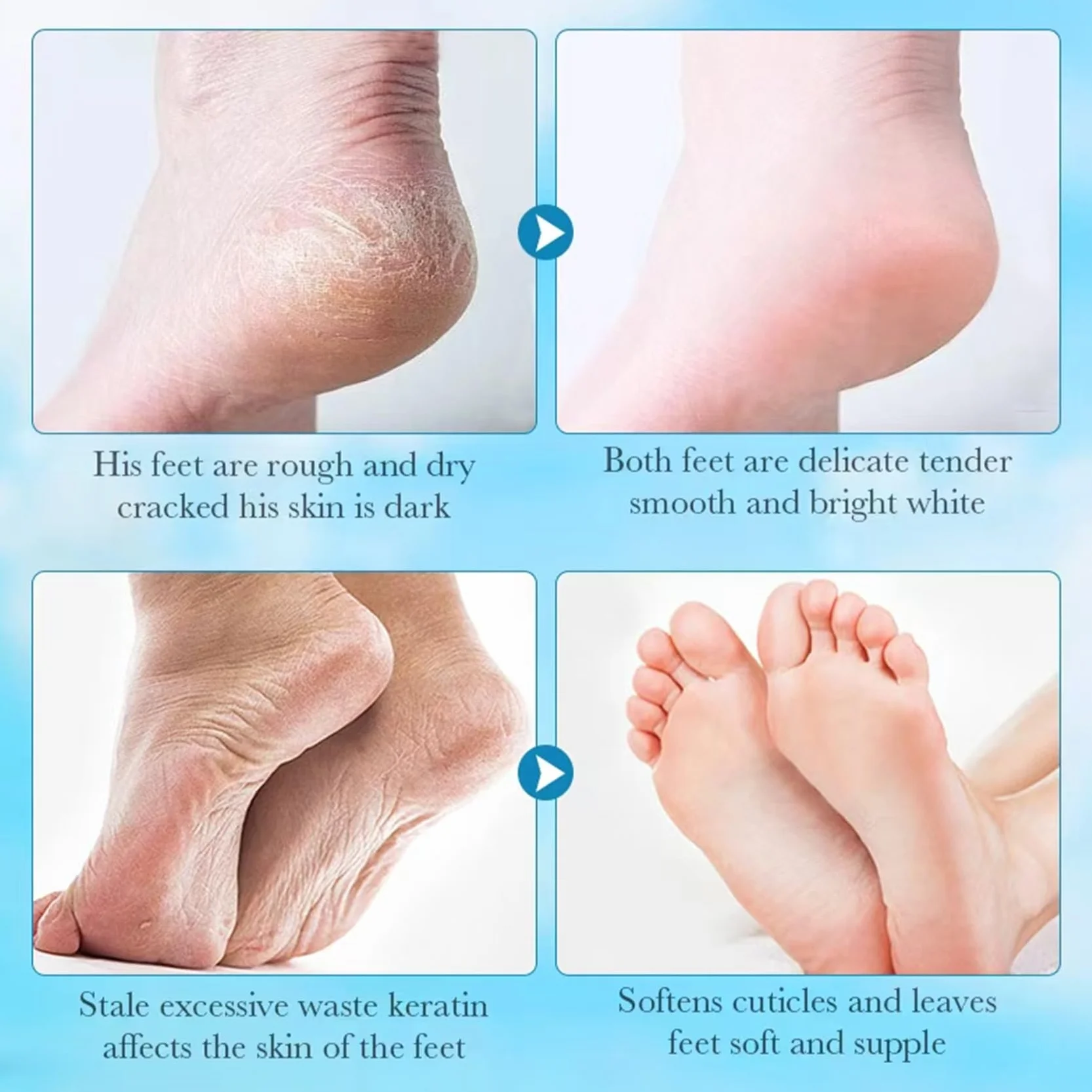 Masque Pied Hydratant Exfoliant Nourrissant 4 Paires Aloe Vera Lavande Soin Callosités Crevasses Pieds Secs