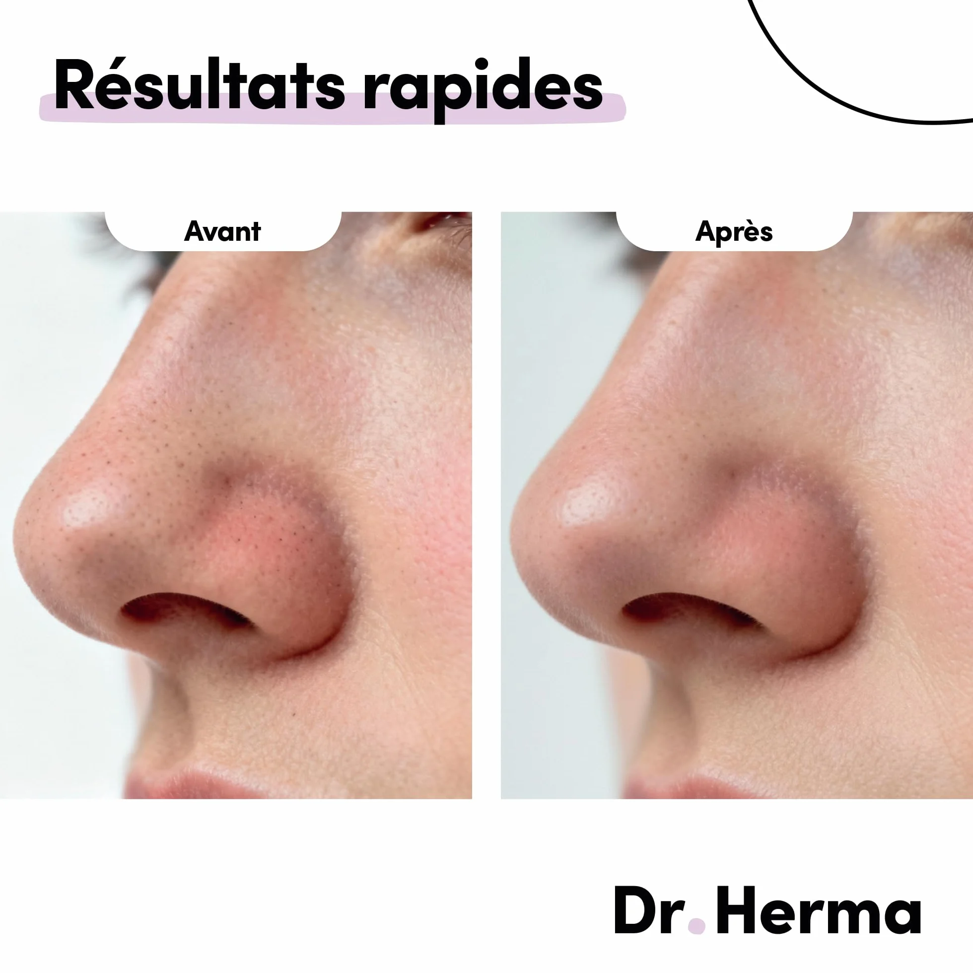 Dr Herma Patch Nez Point Noir 2 étapes Format Nez Purifie Désincruste Ressere les Pores Patch Nasal Anti Imperfection Visage