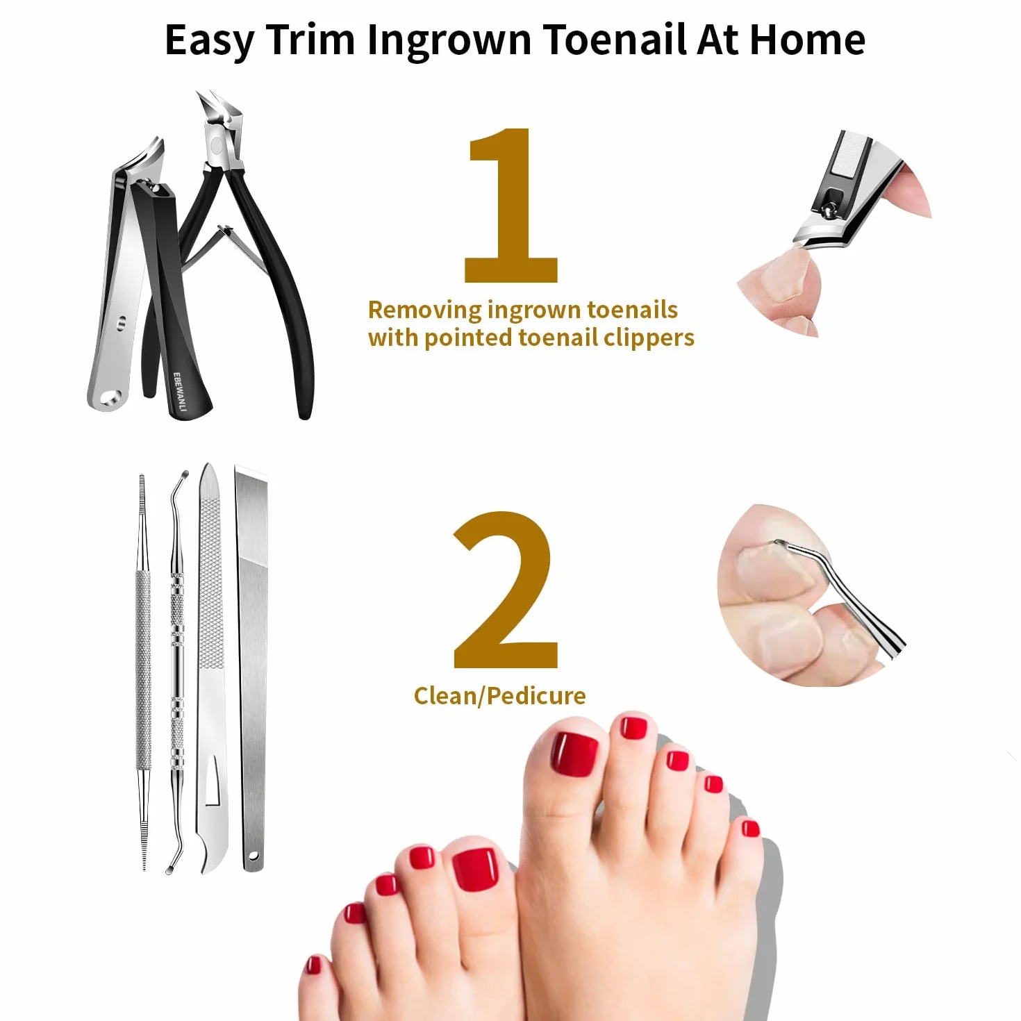 Kit d'enlèvement d'ongle incarné 6 pièces acier inoxydable coupe-ongles droits obliques incurvés outil pédicure
