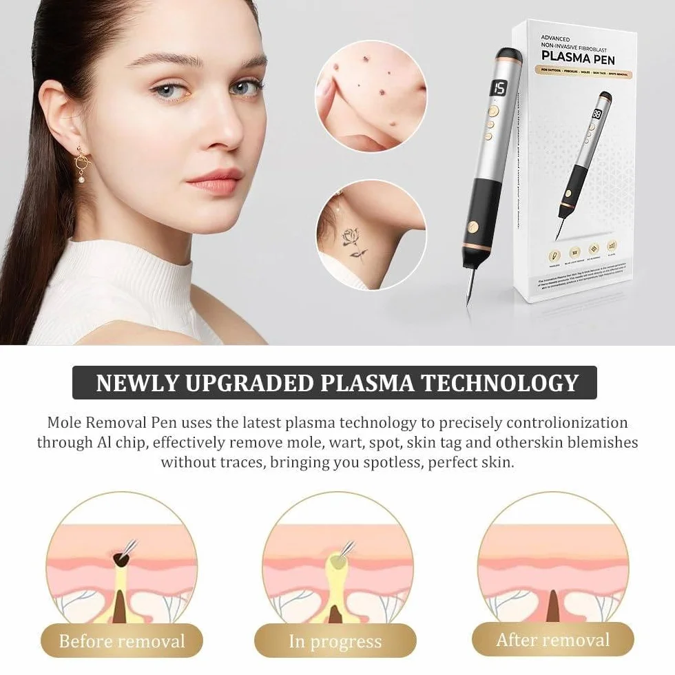 Stylo Plasma à 15 Niveaux pour Éliminer Acrochordons, Taches, Grains de Beauté, Verrues