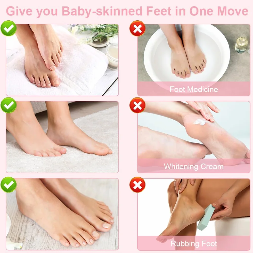 Masque Pieds Peeling Exfoliant 4 Paires Hydratant Rose Chaussette Exfoliante Nourrissant Callosités Crevasses Pieds Secs