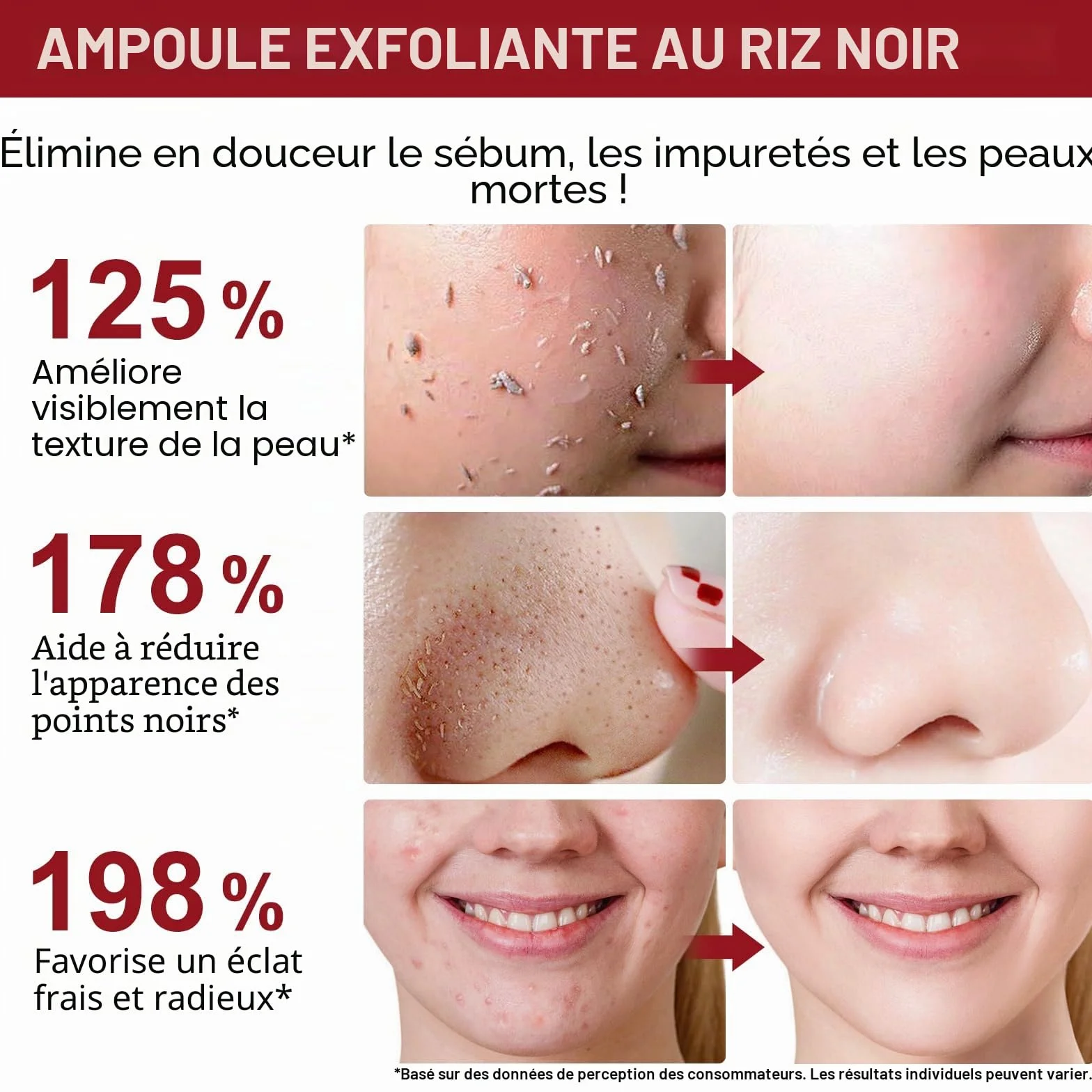 Sérum Exfoliant Visage au Riz Blanc 100ml + Riz Noir 100ml, Peeling Doux AHA BHA VB3, Éclat & Hydratation, Soin Coréen