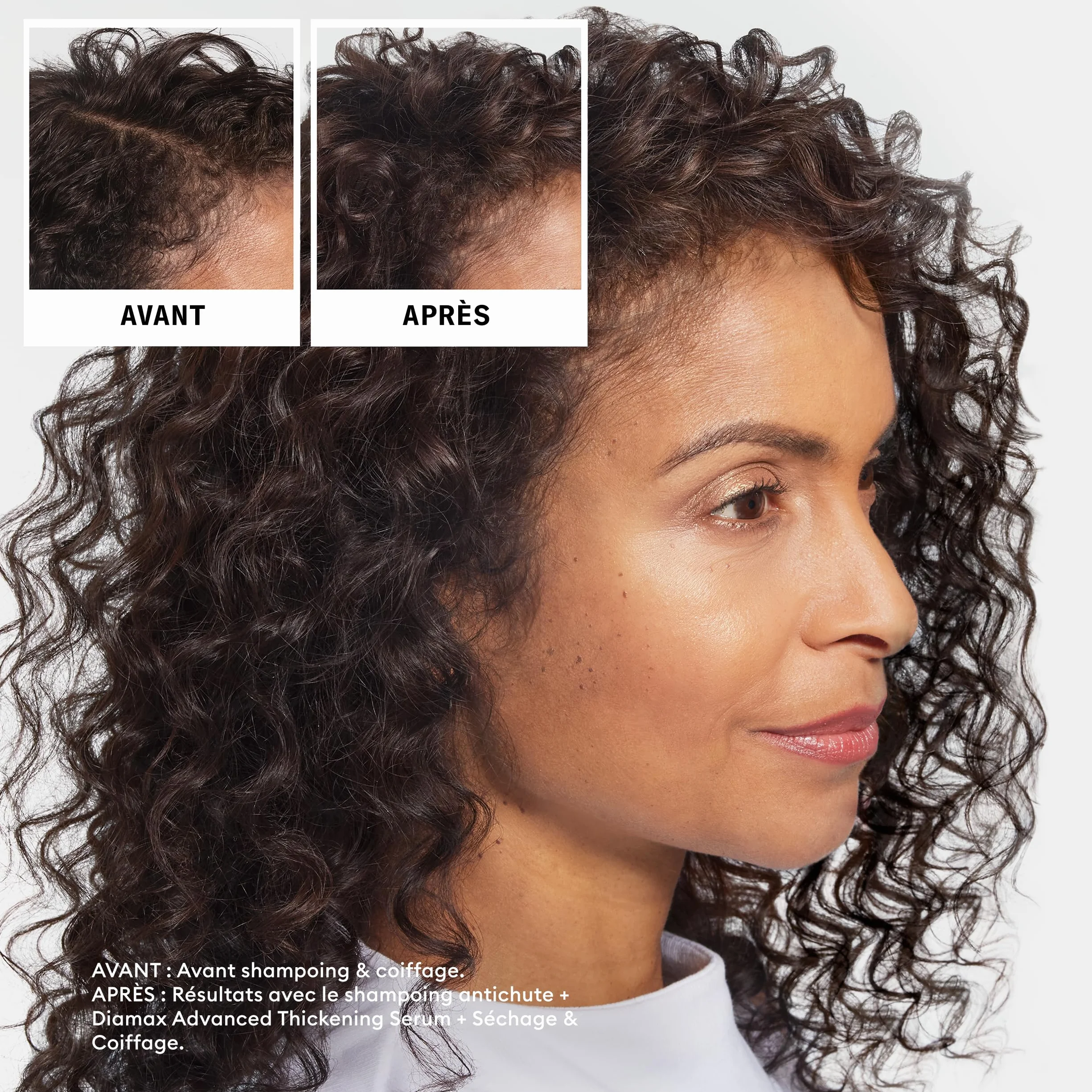 NIOXIN Professional Anti-Hair Loss Shampoing Sérum Antichute Fortifiant Caféine Niacinamide
