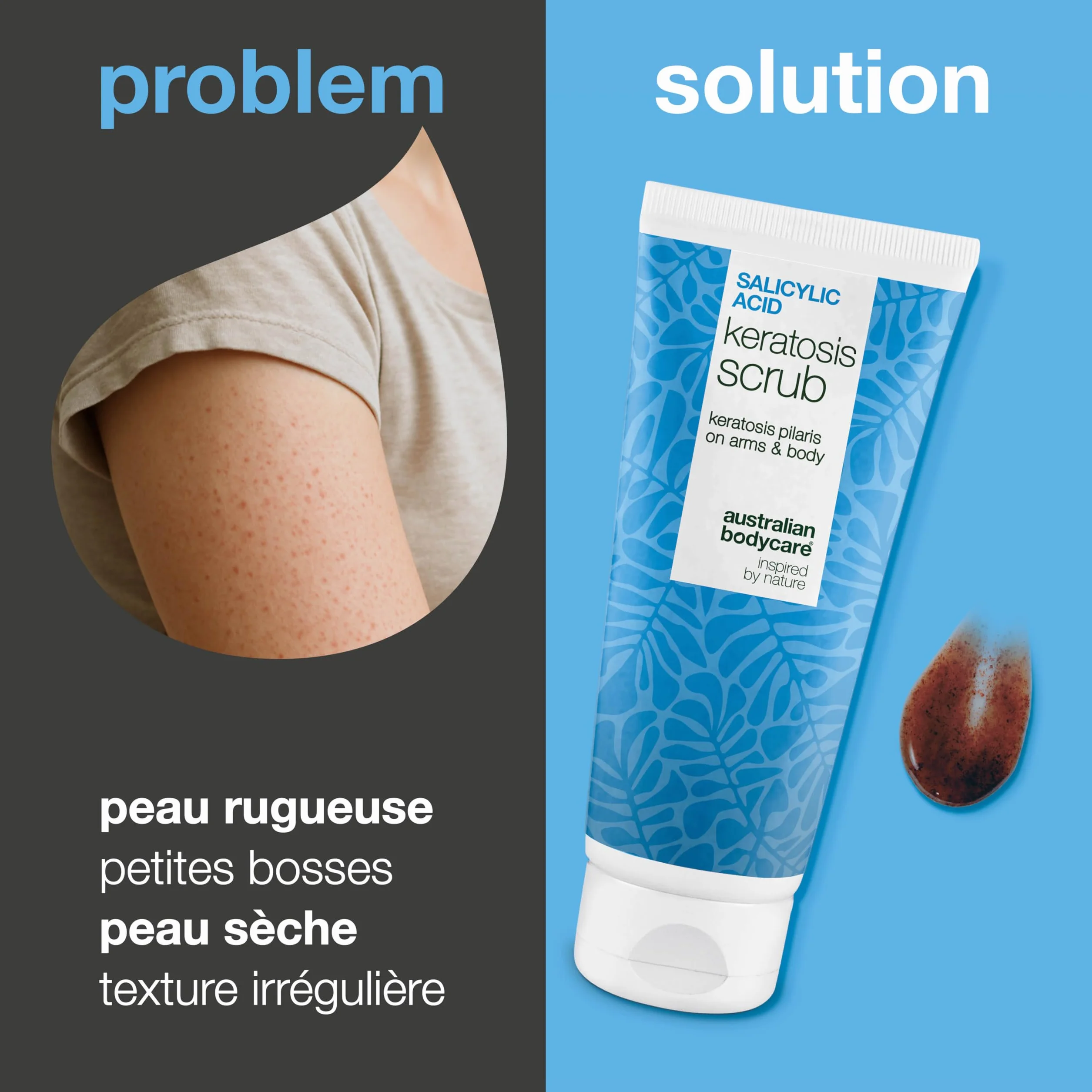 Gommage Corps Exfoliant kératose pilaire AHA/BHA acide salicylique acide glycolique noyau d'abricot double action
