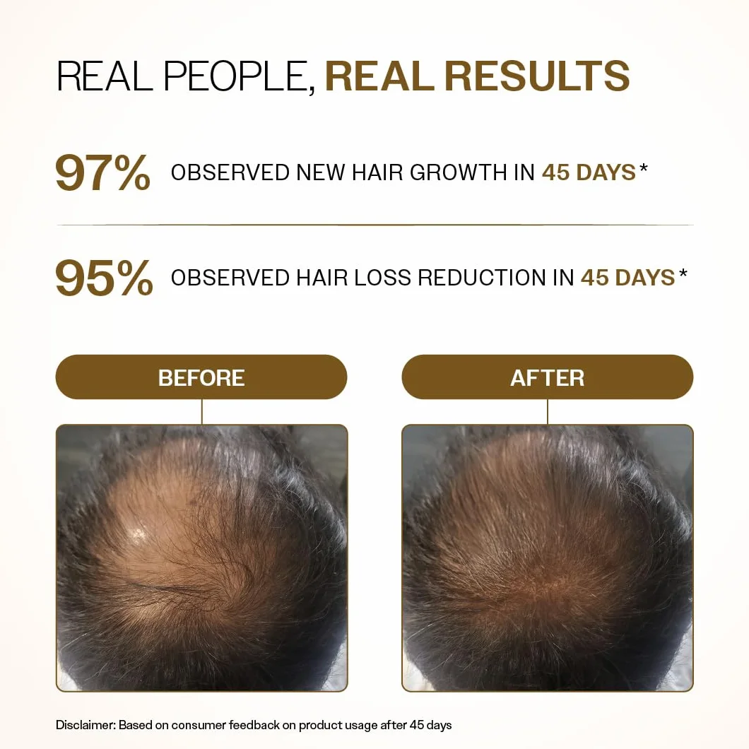 Bare Anatomy Sérum de Croissance des Cheveux Avancé Roll-On 25 ml 3% Rédensyl 4% Anagaine 2% Baïcapil 5% Romarin