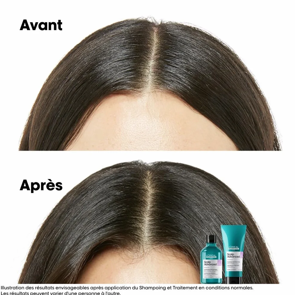 L'OREAL PROFESSIONNEL Scalp Advanced Dermo-Régulateur Anti-Inconfort Cuir Chevelu Sensible Sans Silicone