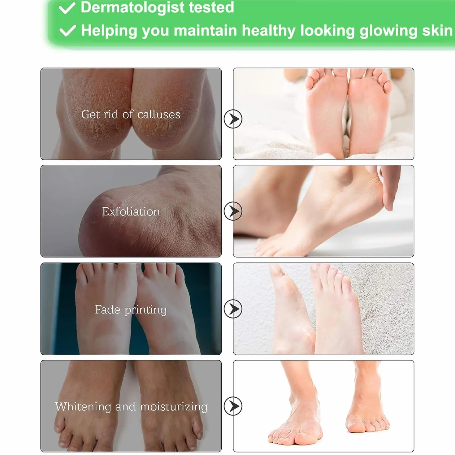 Lot de 3 paires de masques pour les pieds - Soin des callosités et des peaux mortes - Masque anti-âge exfoliant - Pour femmes et hommes - Rose classique