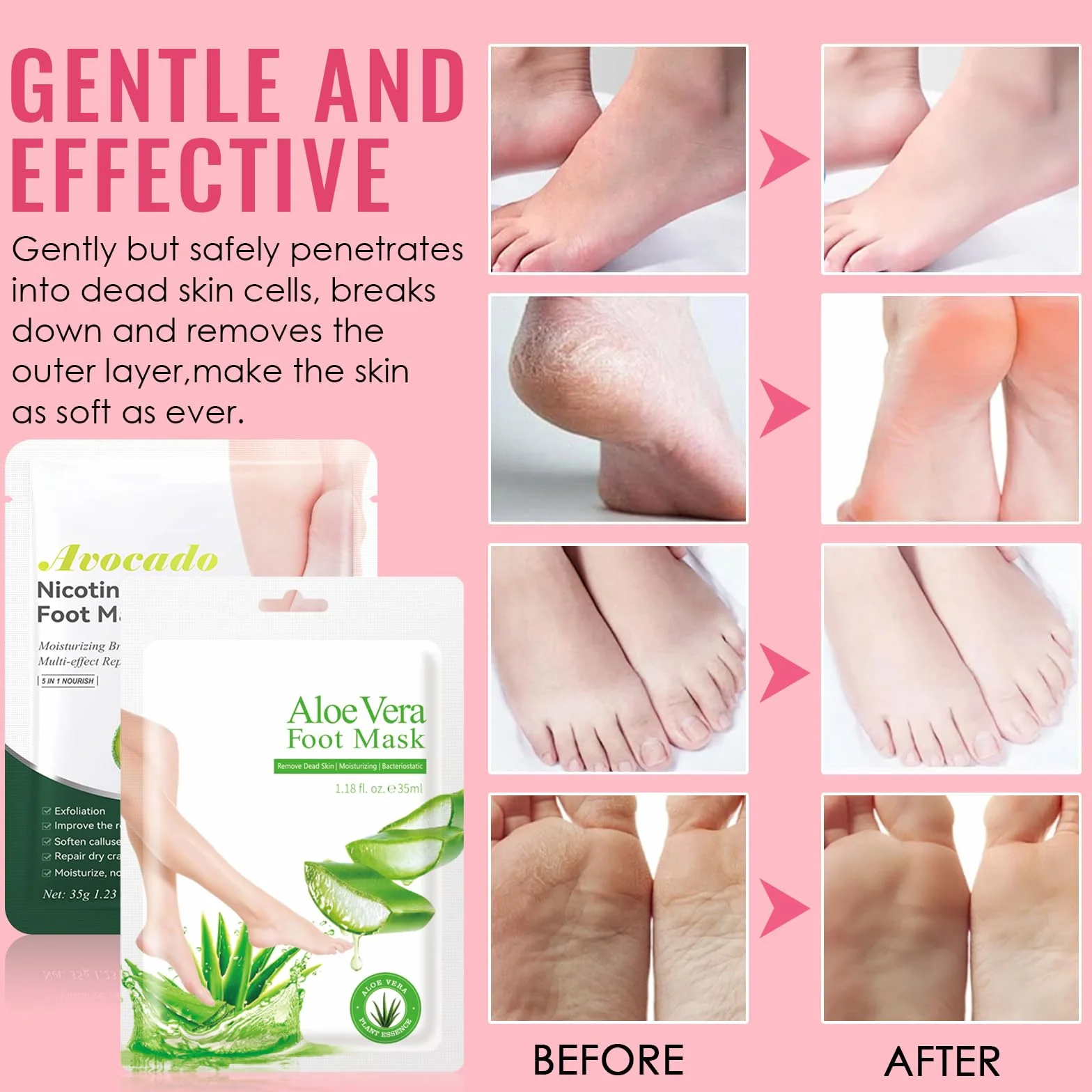 Masque Pieds Peeling Exfoliant Aloe Vera Avocat, Soin Hydratant pour Callosités et Crevasses, Femmes & Hommes