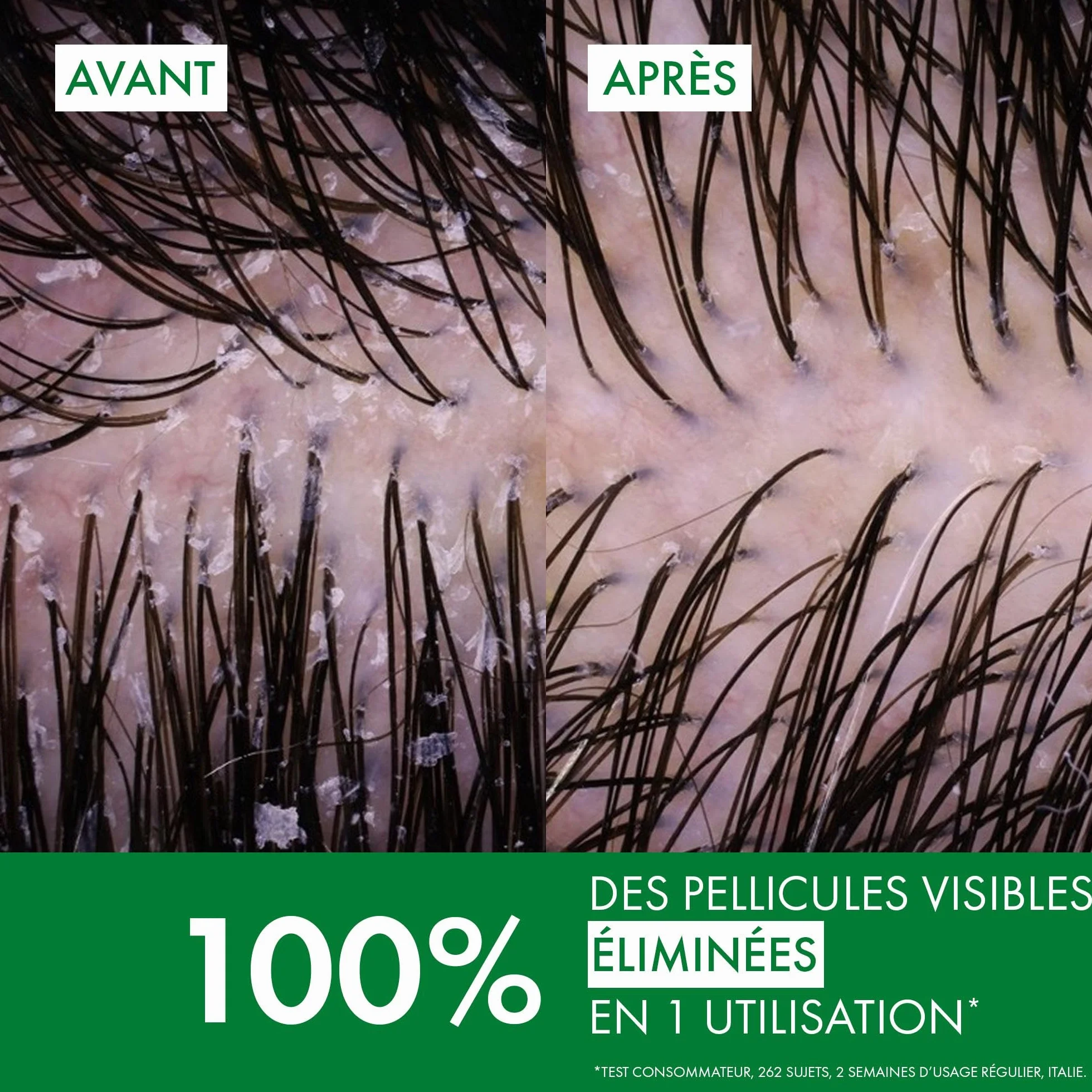 Vichy Dercos Shampooing Anti-Pelliculaire DS Pellicules Démangeaisons Cheveux Secs