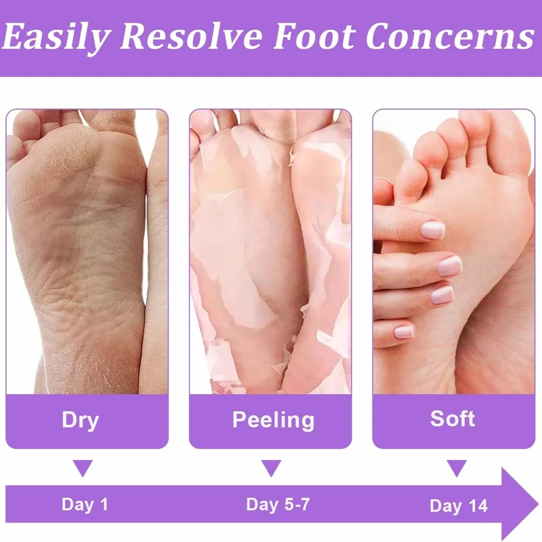 Masque peeling pieds exfoliant, 2 paires, Callus peeling