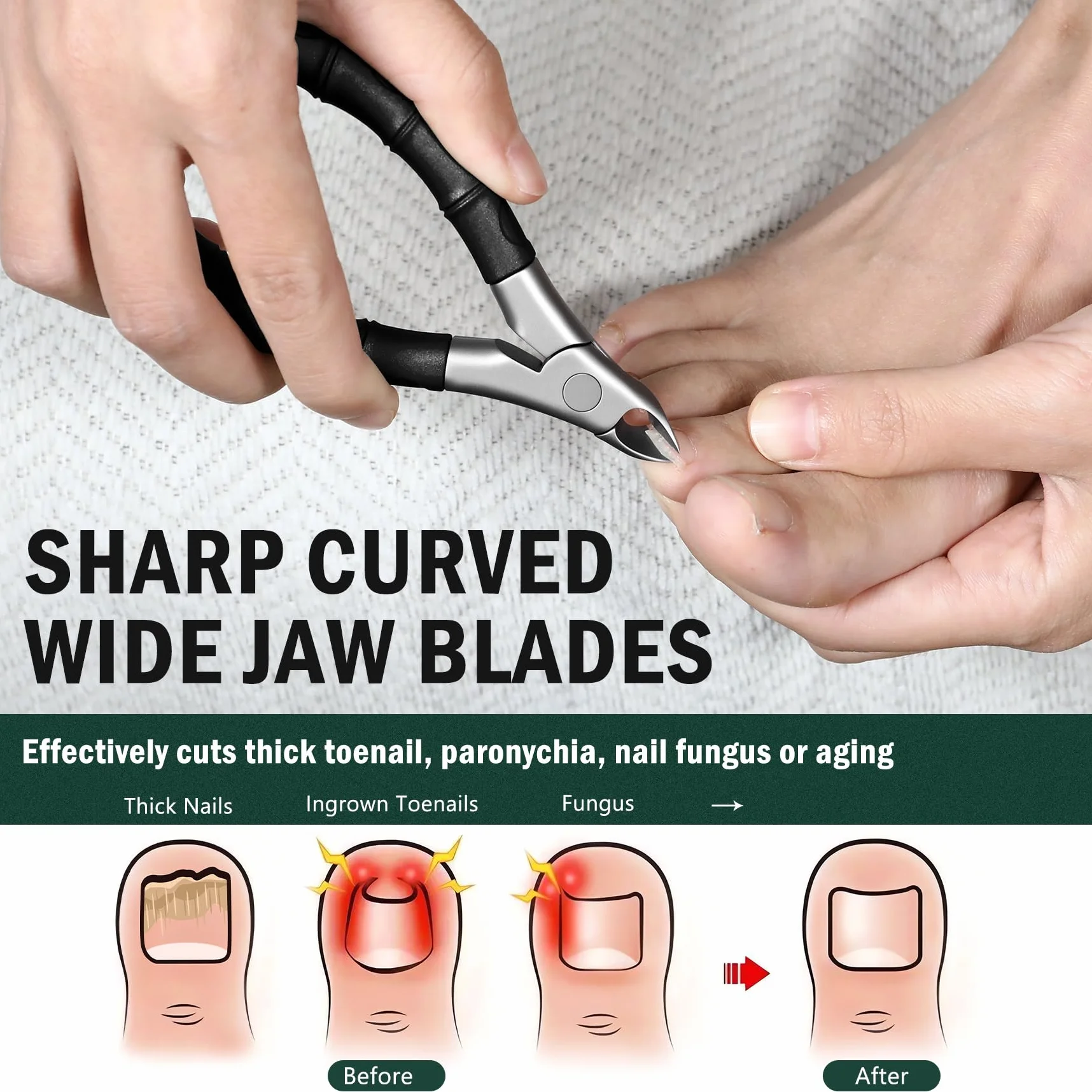 Coupe-ongles Epais Pied à mâchoires Larges Ouvertes, Pince Ongles Incarne Pieds Antidérapant à Long Manche pour Personnes âgées, Ciseaux a Ongles Pieds de Précision Noir