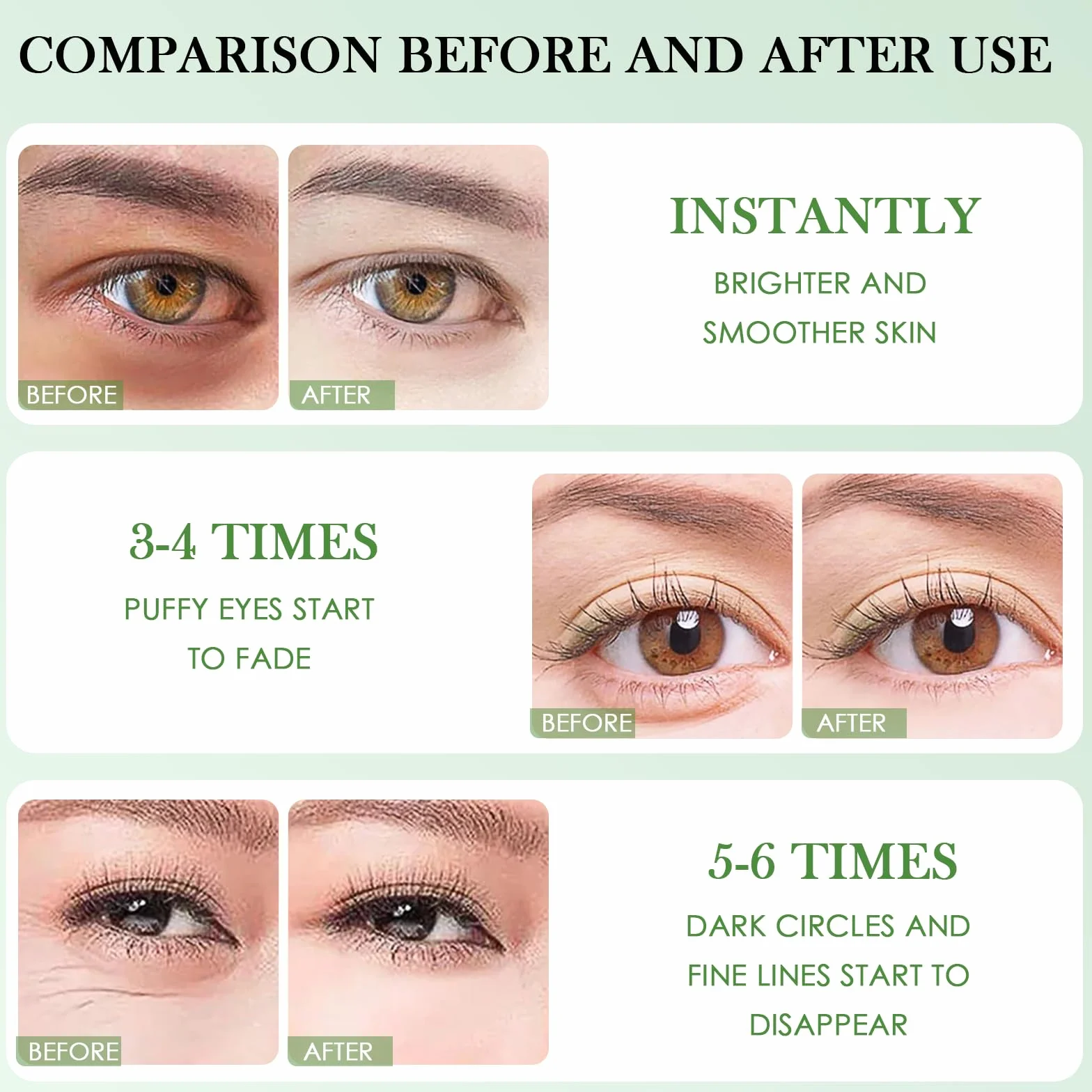 60 Pièces Patch Yeux Anti Cernes Aloe Vera, Masque pour les Yeux Éclaircir et Nourrir le Contour