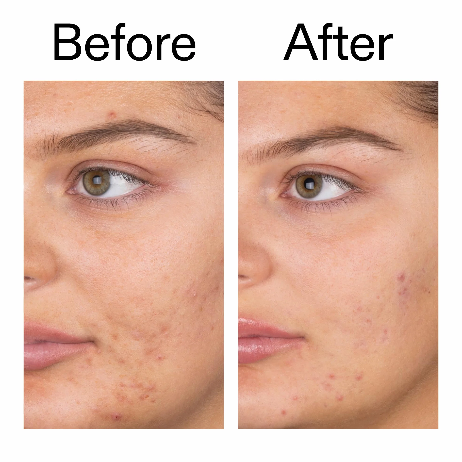 The INKEY List Salicylic Acid Cleanser 60ml