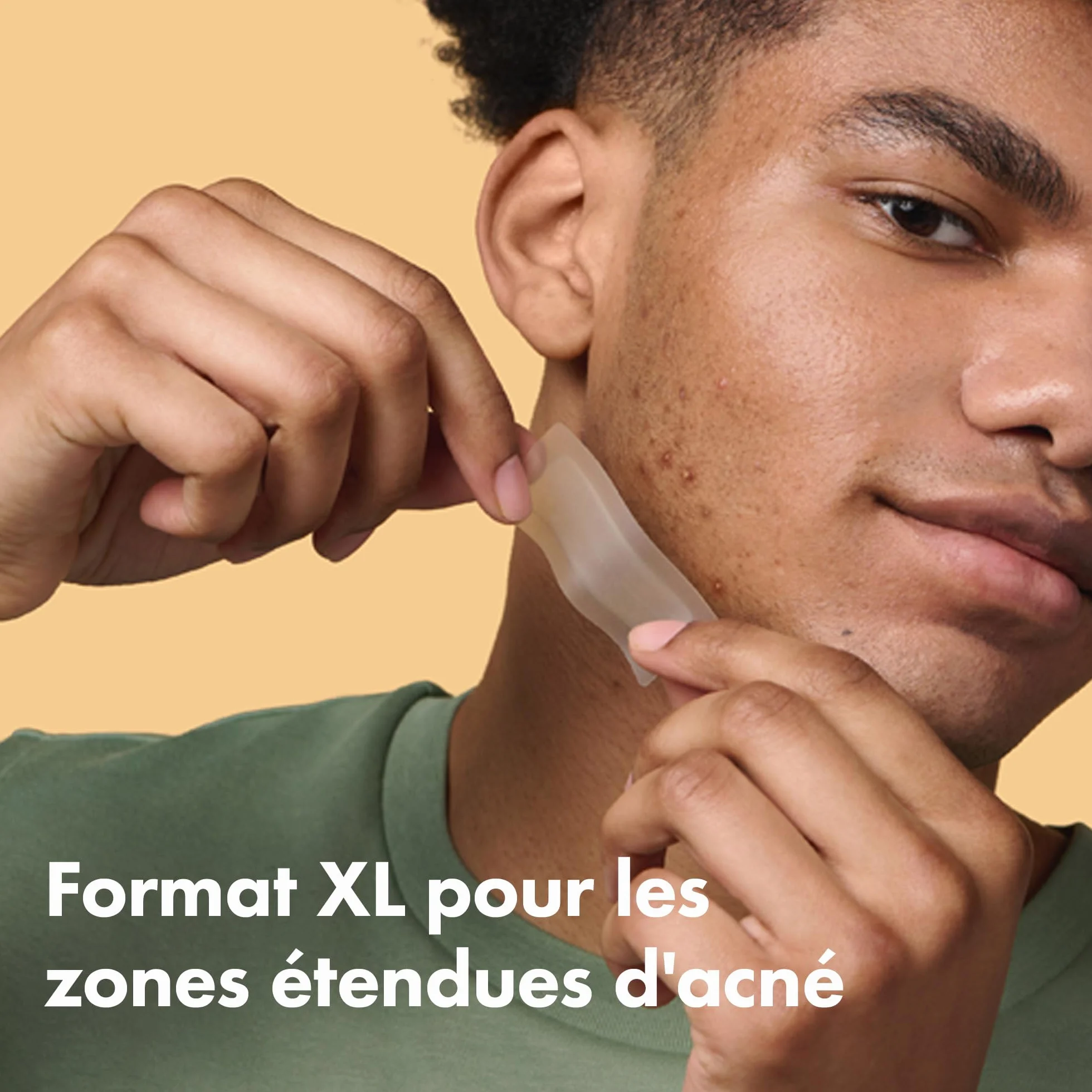 Hero Mighty Patch Surface: Patch anti-acné XL à l'Hydrocolloïde, 10 patchs