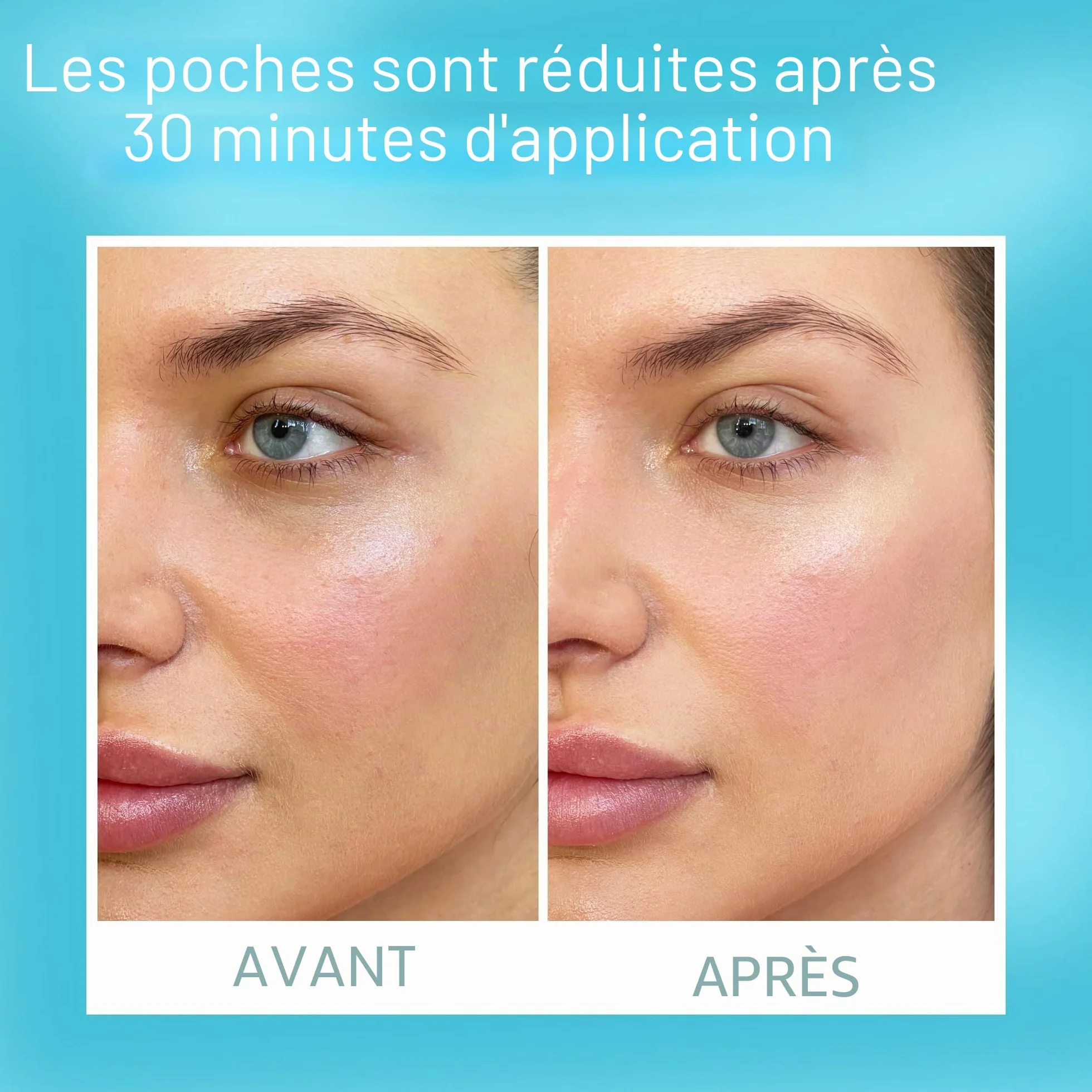 TALIKA Eye Therapy Patch Anti Cernes Poches Réutilisable Soin Yeux Fatigués 1 paire