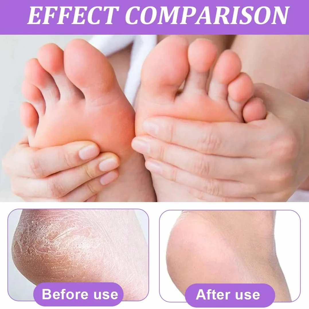 Masque peeling pieds exfoliant, 2 paires, Callus peeling