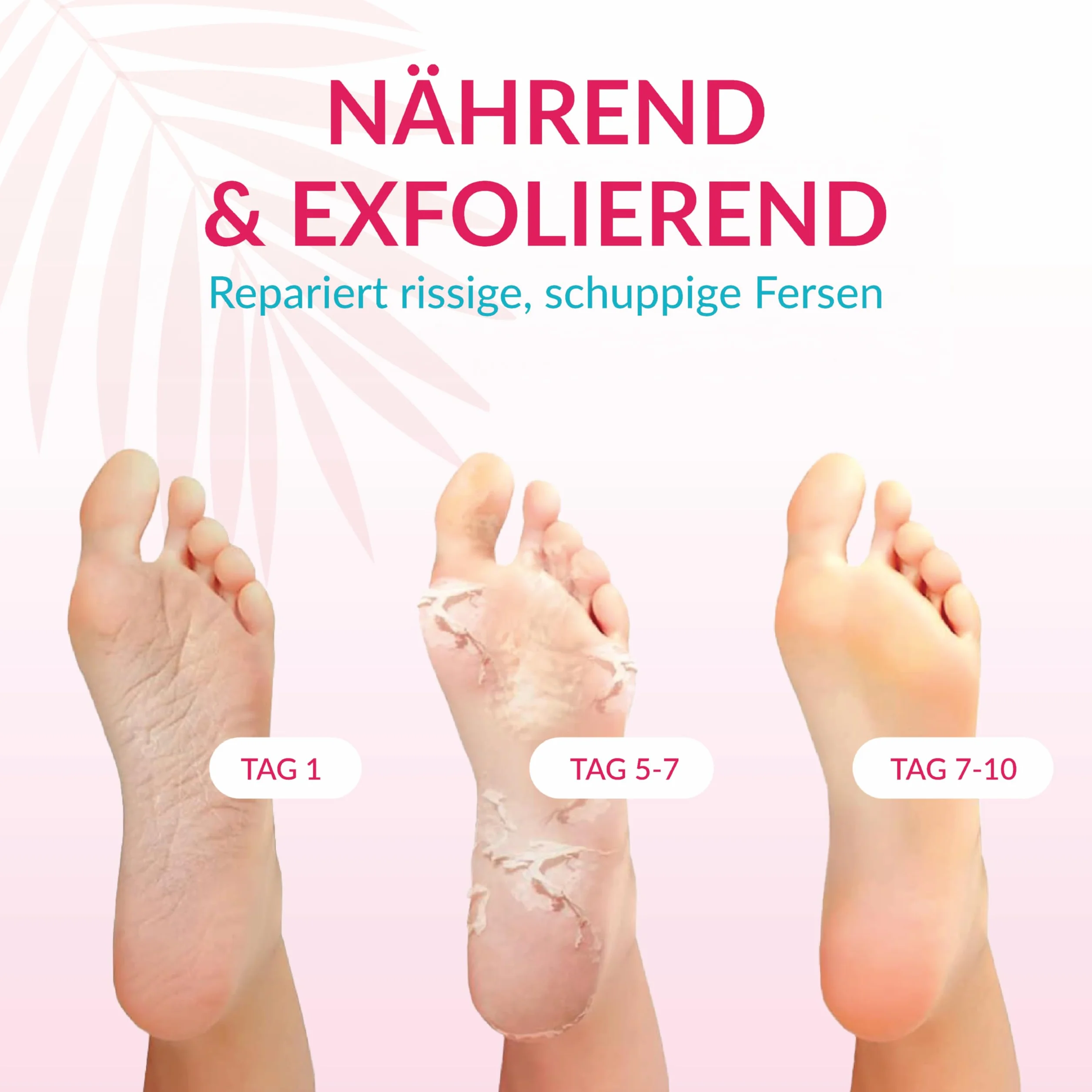 Chaussettes anti-callosités premium 2 paires - Masque pour callosités - Soins des pieds efficaces