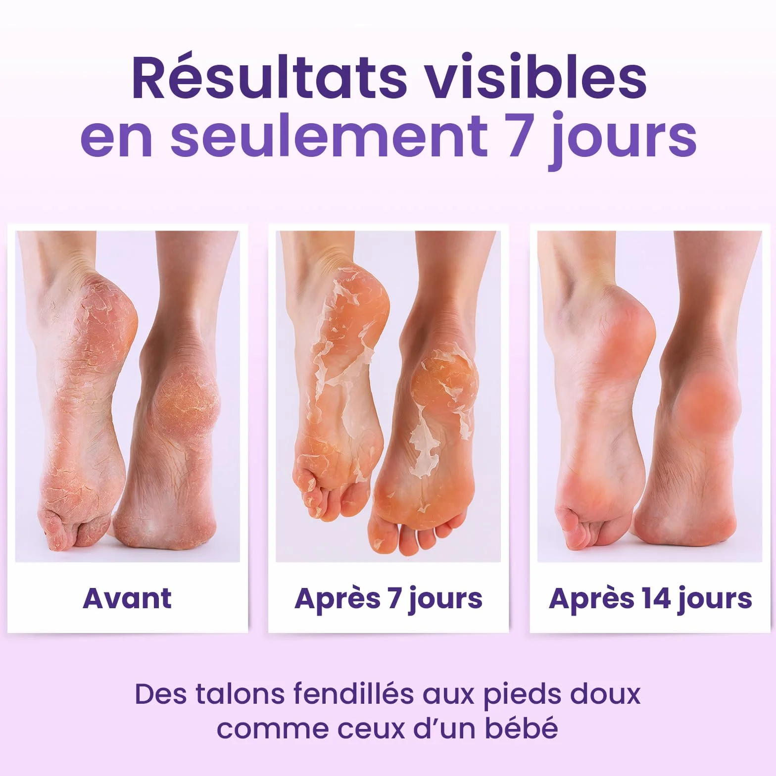 Masque Pied Exfoliant 6 Paires – Peeling Pied Hydratant au Beurre de Karité & Lavande, Chaussettes Exfoliantes