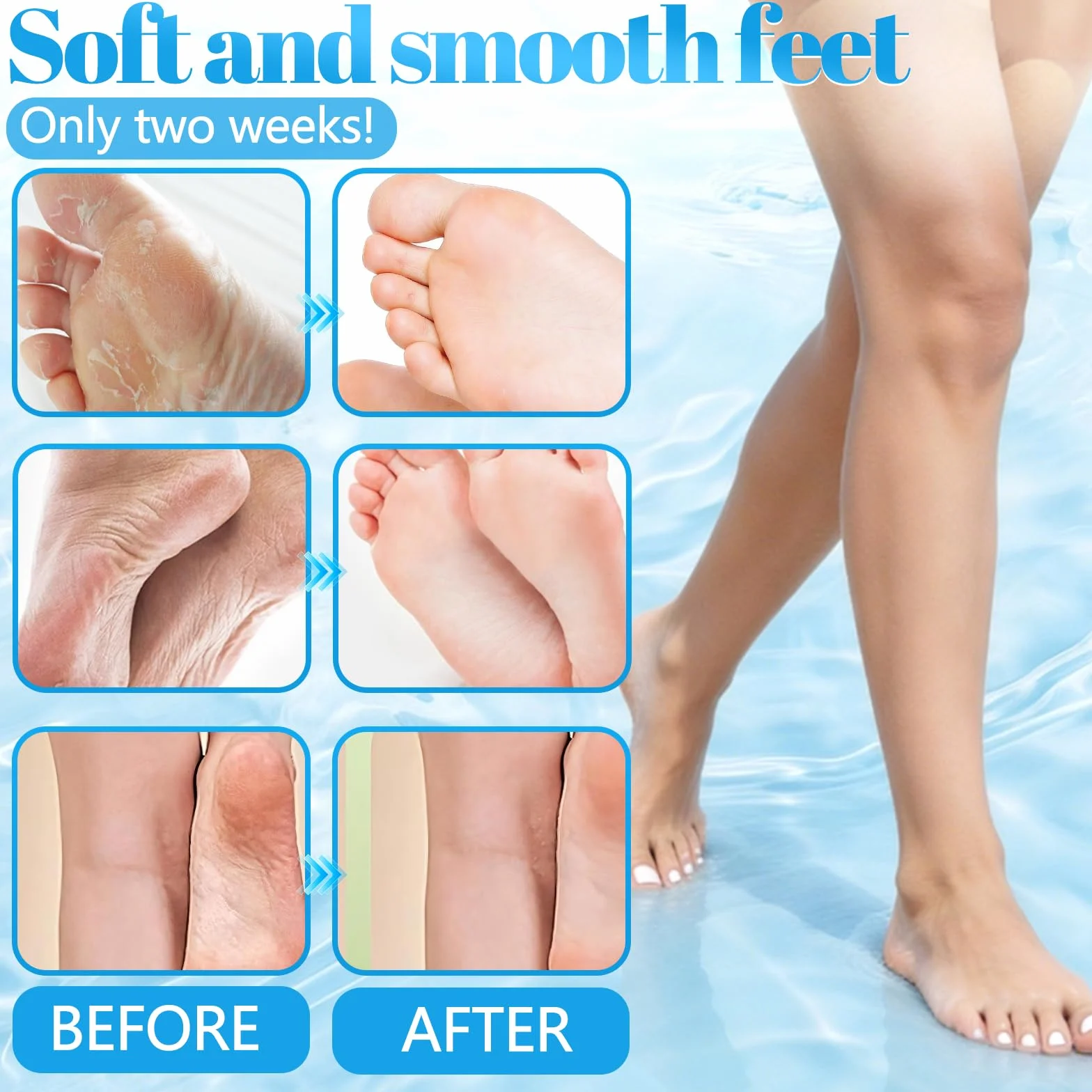 Masque Pieds Nourrissant Chaussettes Hydratantes Pieds Très Secs Abîmés Lavande Noix De Coco Aloès 3 Paires