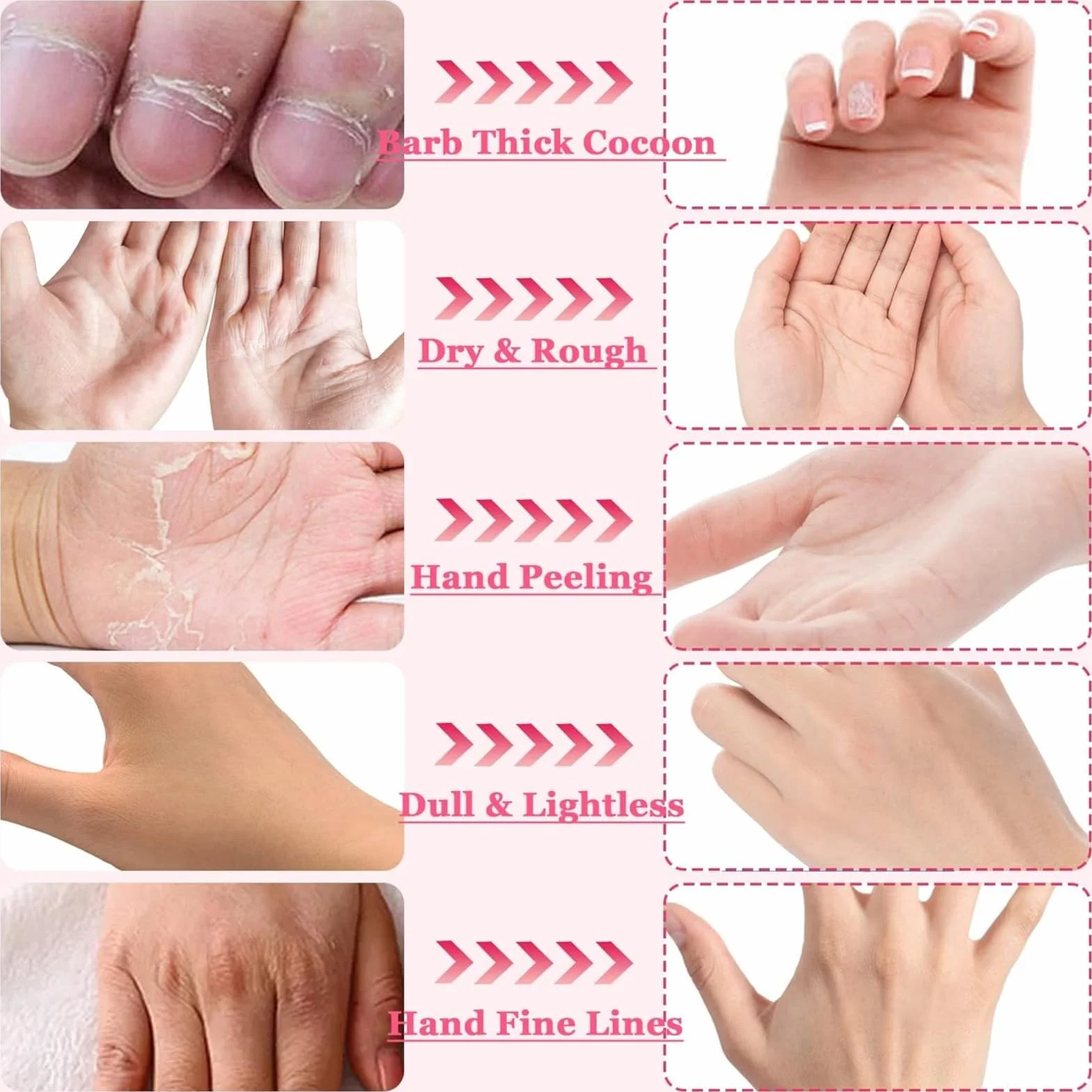 Masque Pour Les Mains Hydratant Gants Nuit Peau Sèche Gercée Réparation 8 Pièces