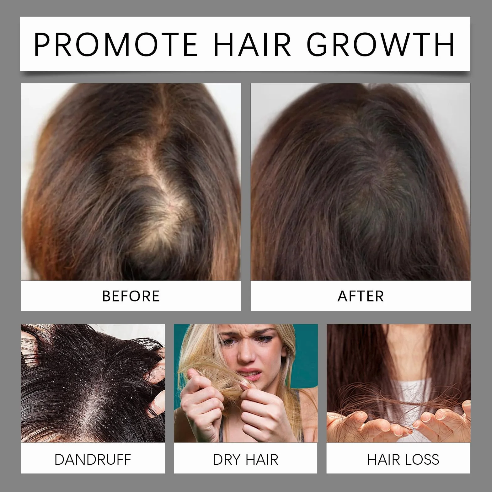 Huile Pousse Cheveux Anti-Chute Sérum Naturel Huile De Ricin Gingembre Booster Croissance Cheveux 30ml