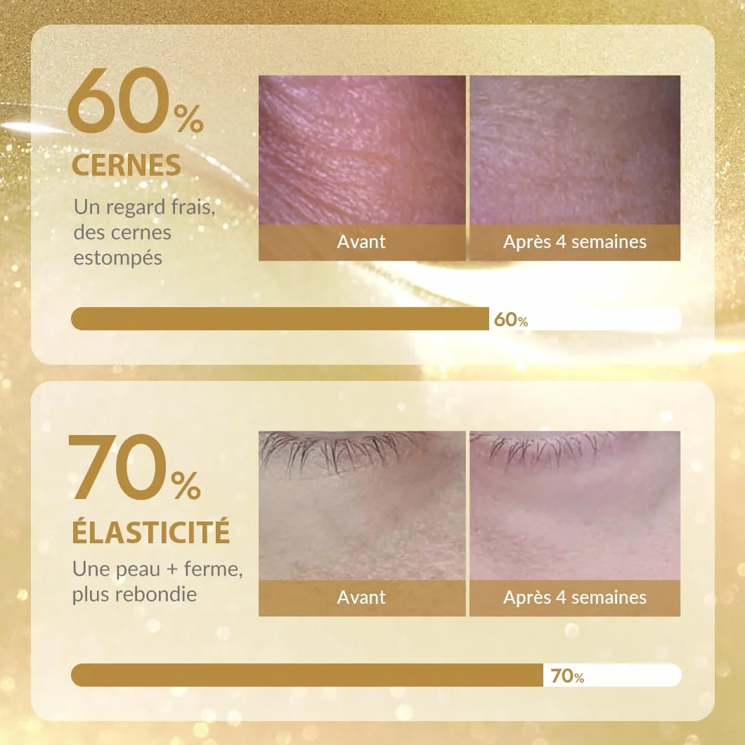 MIZON SNAIL REPAIR GOLD EYE GEL PATCH x60 Soin coréen Anti cernes Anti-âge Extrait de Bave d'Escargot
