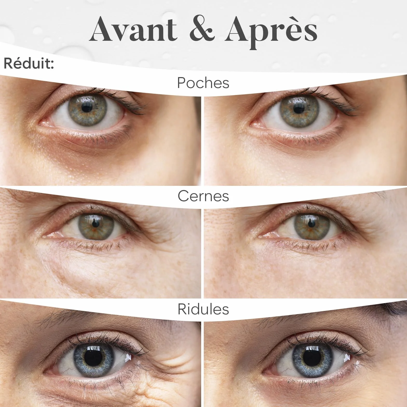 BLOOMORA Patch Yeux Anti Cernes Niacinamide Acide Hyaluronique 30 paires