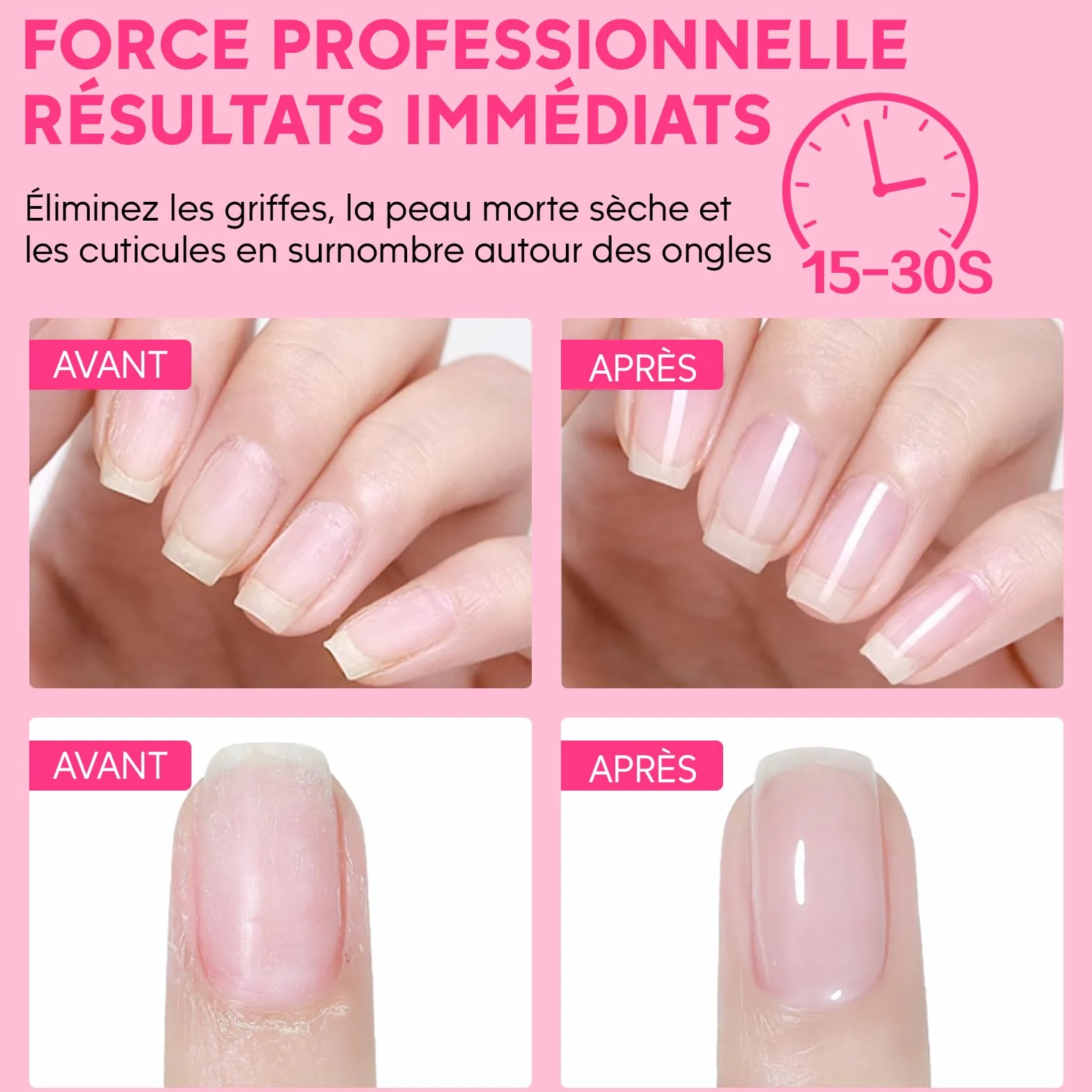 Kit élimination cuticules rose - Crème, huile, coupe-ongles, pousse-cuti et pince